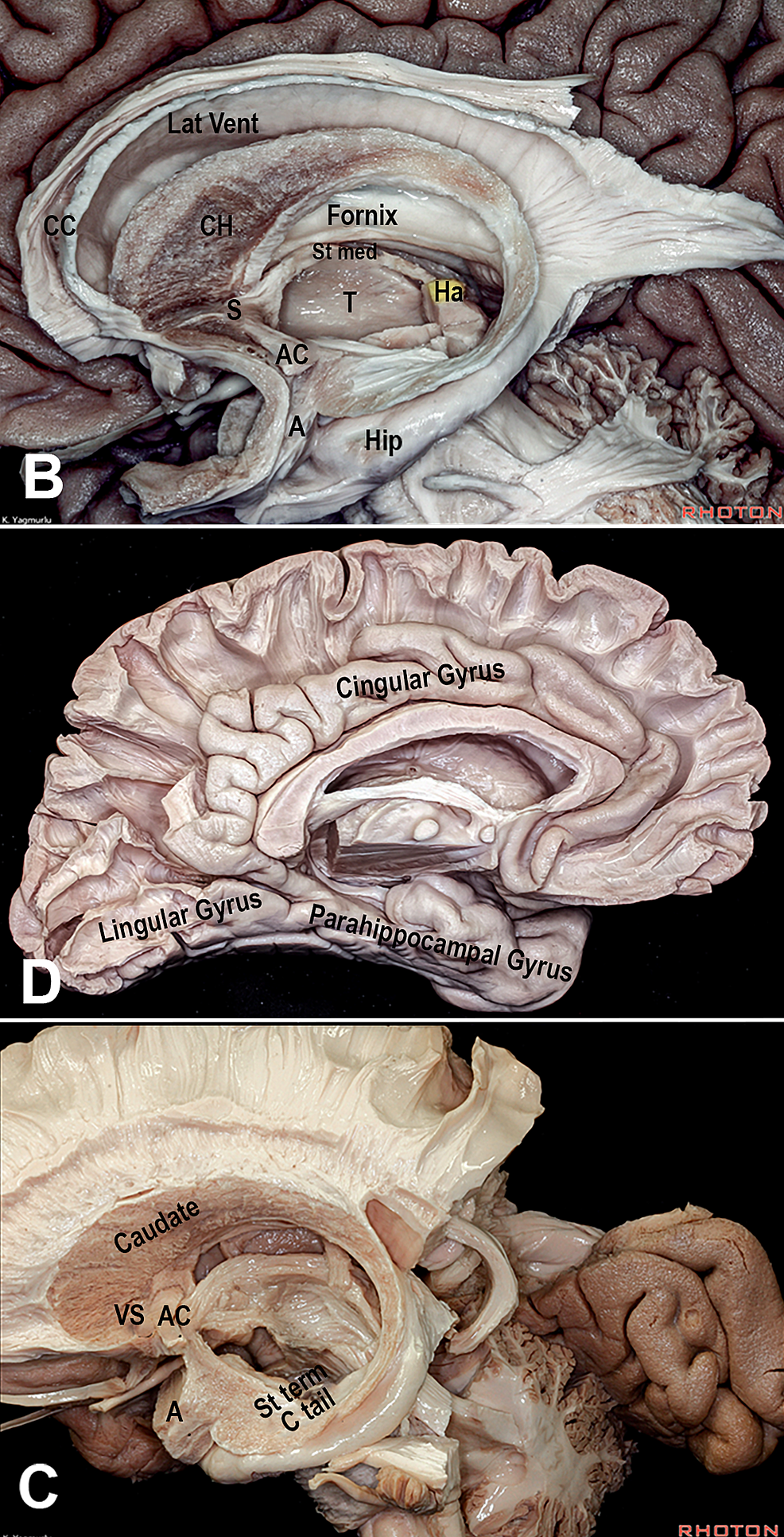 Dissections-from-the-Rhoton-Collection-of-the-limbic-system