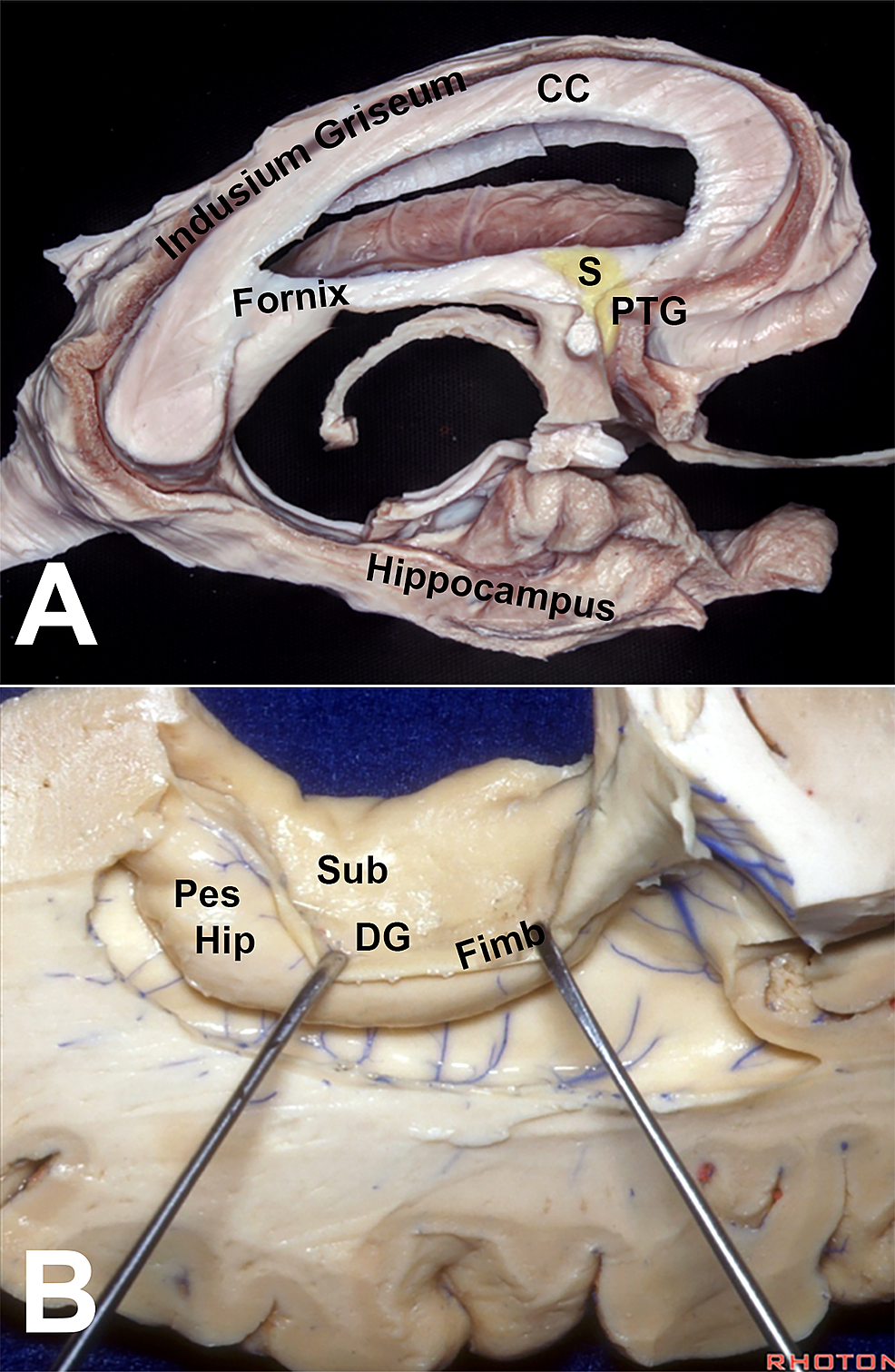 Dissections-showing-the-different-parts-of-the-hippocampal-formation