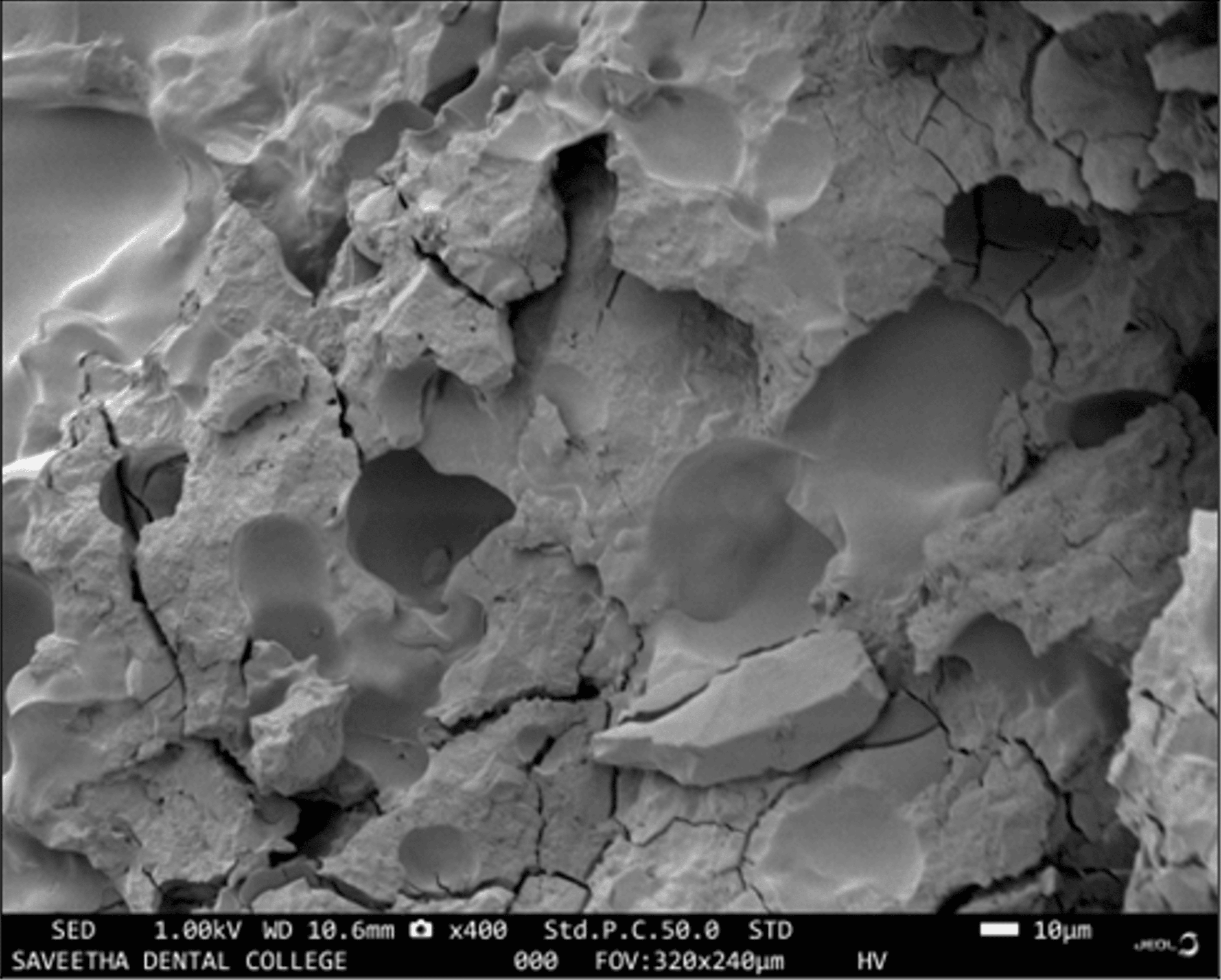 Cureus ChitosanReinforced Gelatin MicrospheresModified Glass