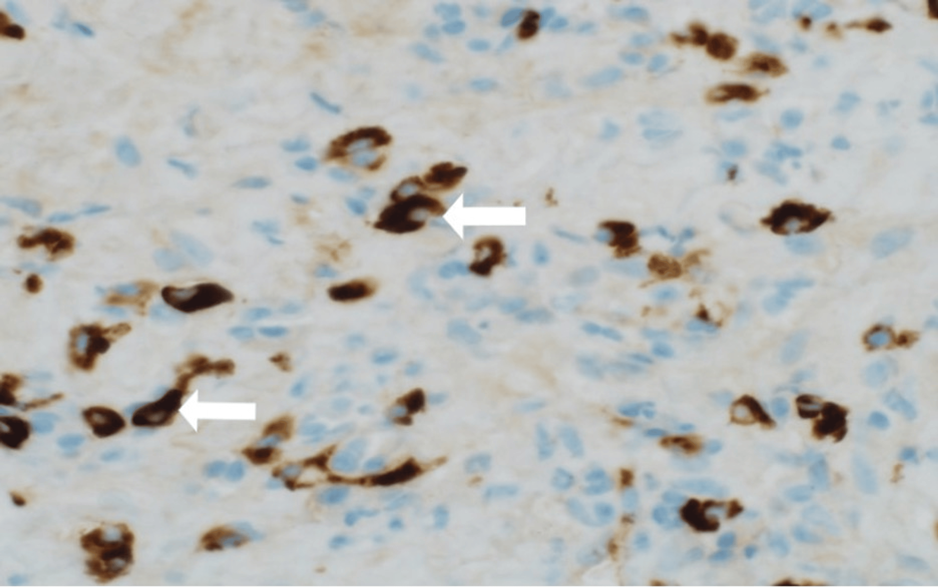 B Positive Plasma Aramingo - gecf898