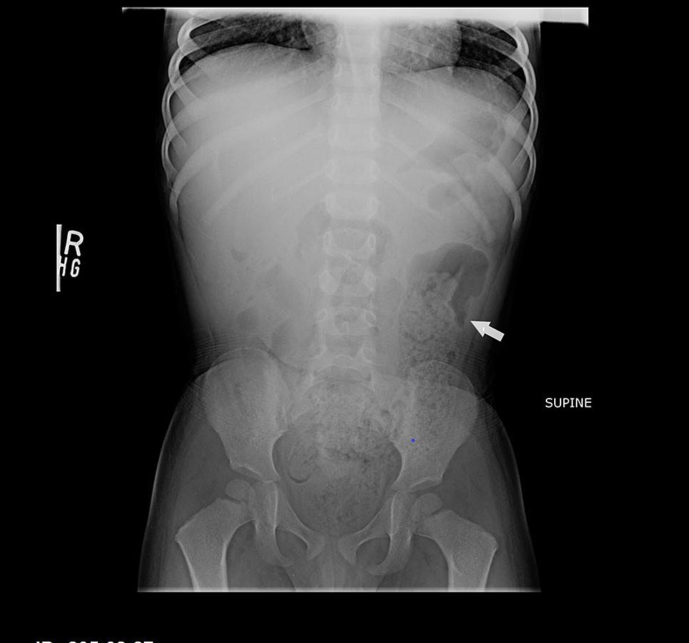 Repeat-abdominal-X-rays-upon-readmission