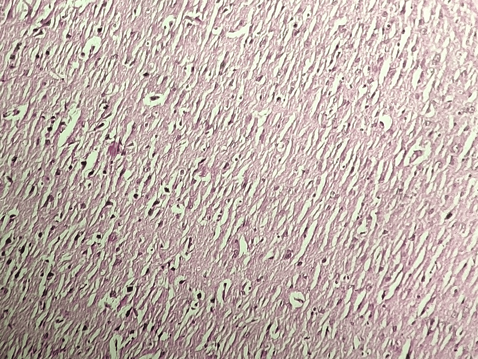 Enhanced Neuroprotective Synergy of Atorvastatin and Magnesium L