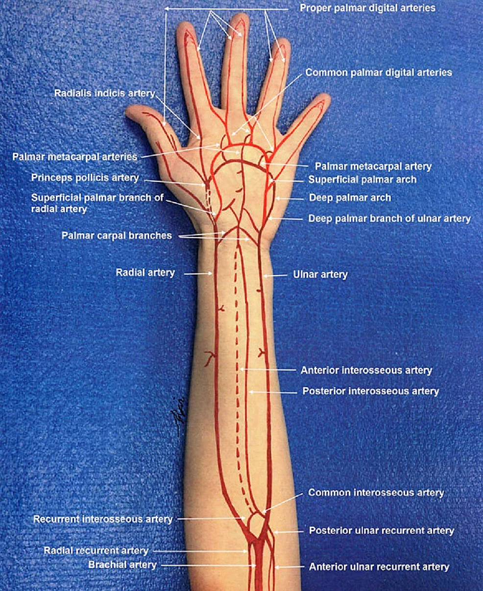 Forearm Vascular Anatomy   Article River 1cc9ffb0d43b11e982f445f121654dfa Arterial Circulation In The Forearm And Hand 2  