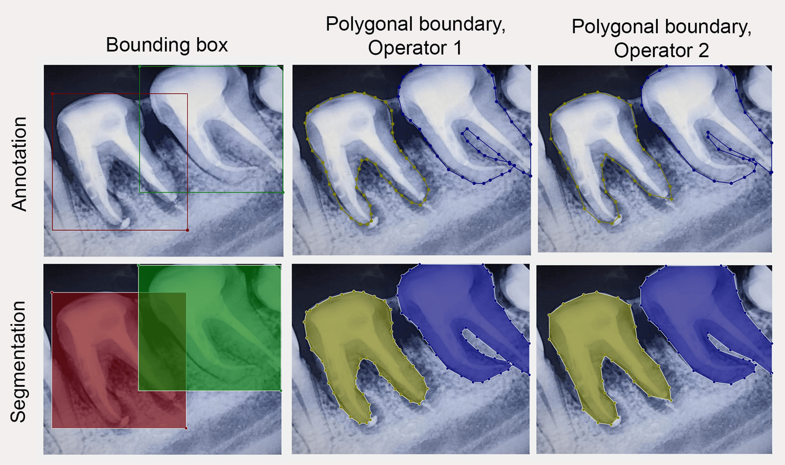 Clinical Annotation And Segmentation Tool (CAST) Implementation For ...