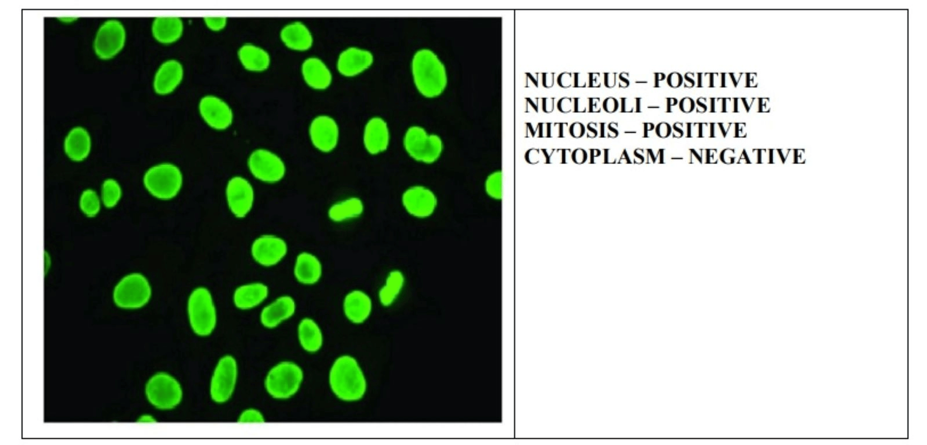 Cureus | The Role of Indirect Immunofluorescence (IIF) and Line ...