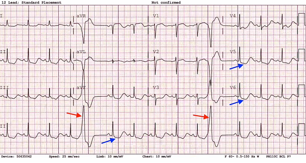 医師が合併症を最小限に抑える方法
