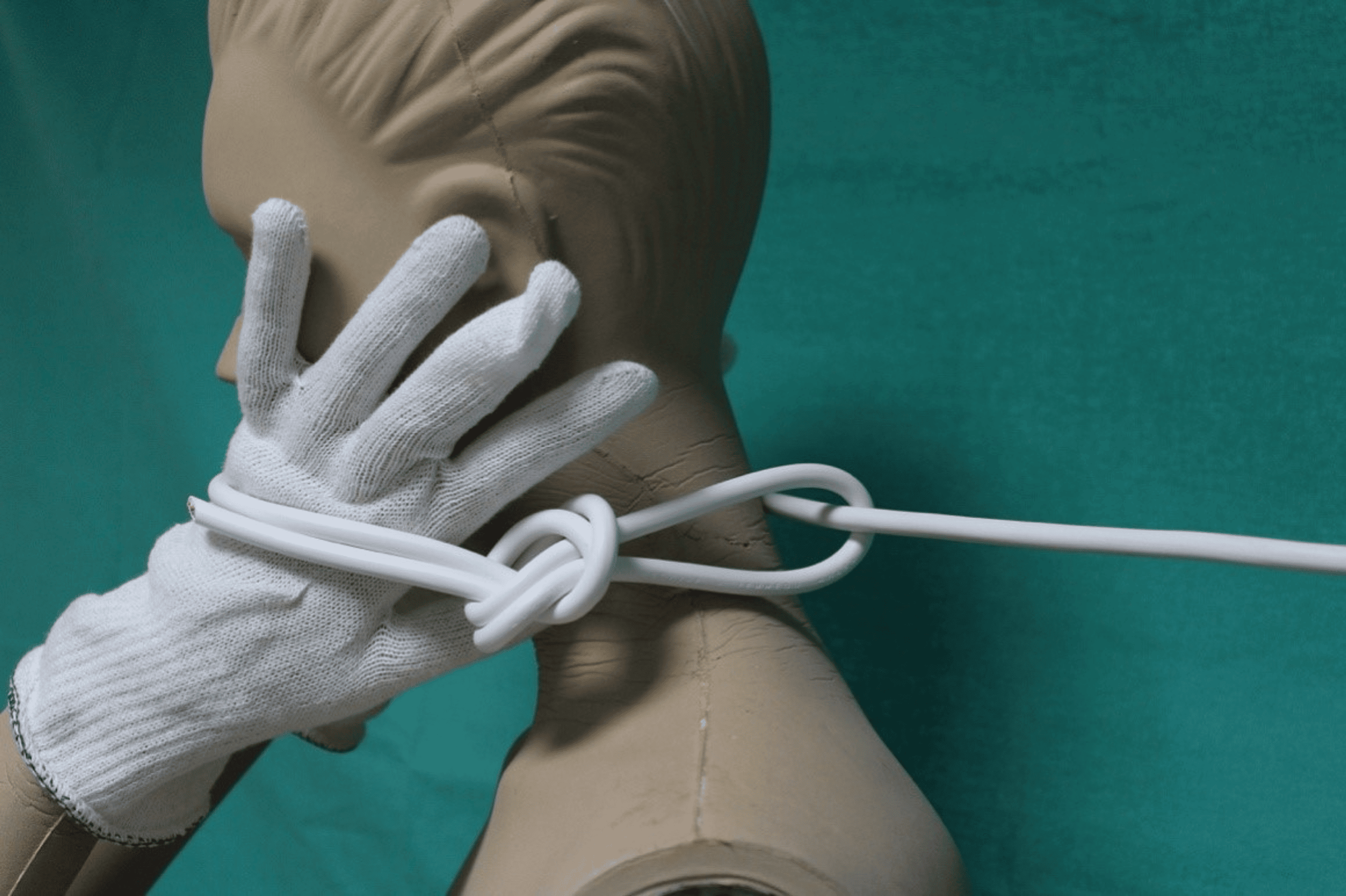 Cureus Reconstruction of Trauma Dynamics Due to Ligature Strangulation by Using a Dynamometer