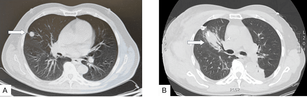 Cureus | Perioperative Management of a Patient With Multiple ...