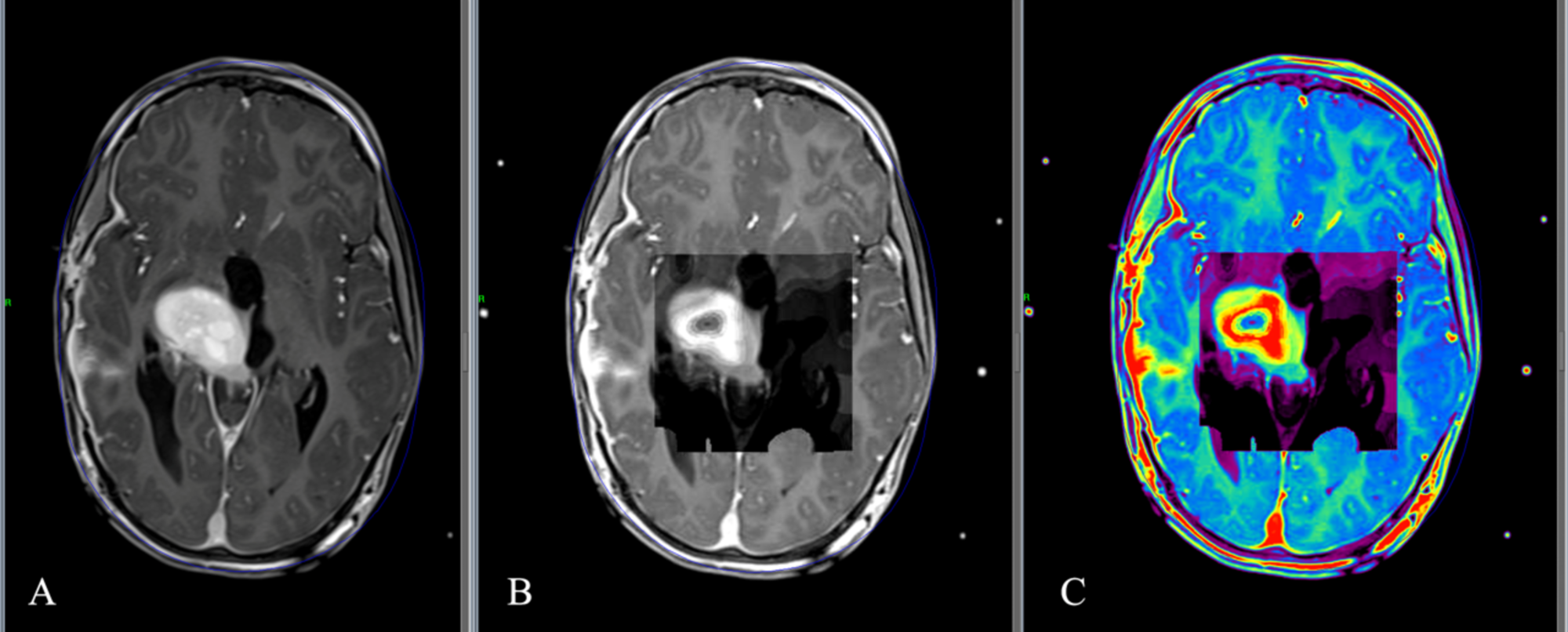 osirix md stanford osirix md stanford