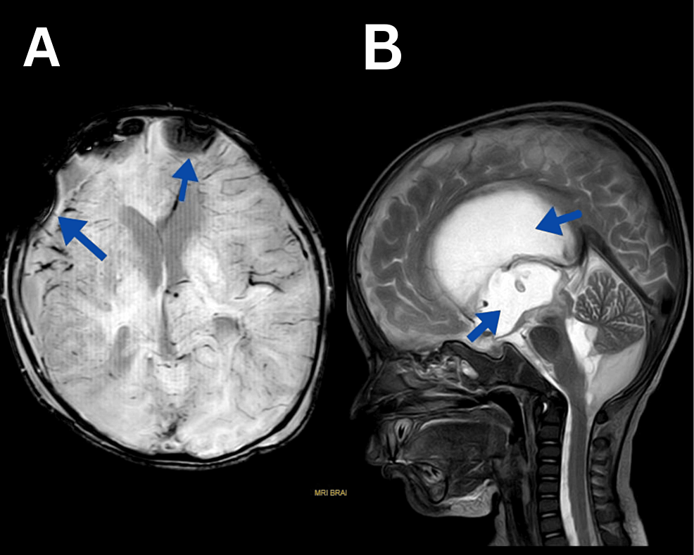 Belly Up or Down What are we missing? Prone vs. Supine MRI