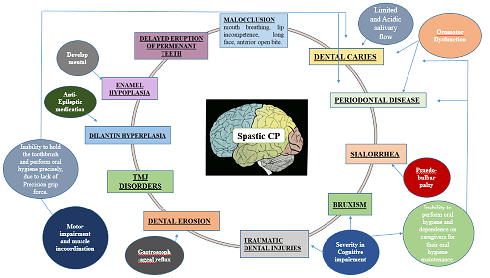 Cureus Navigating Oral Hygiene Challenges in Spastic Cerebral Palsy