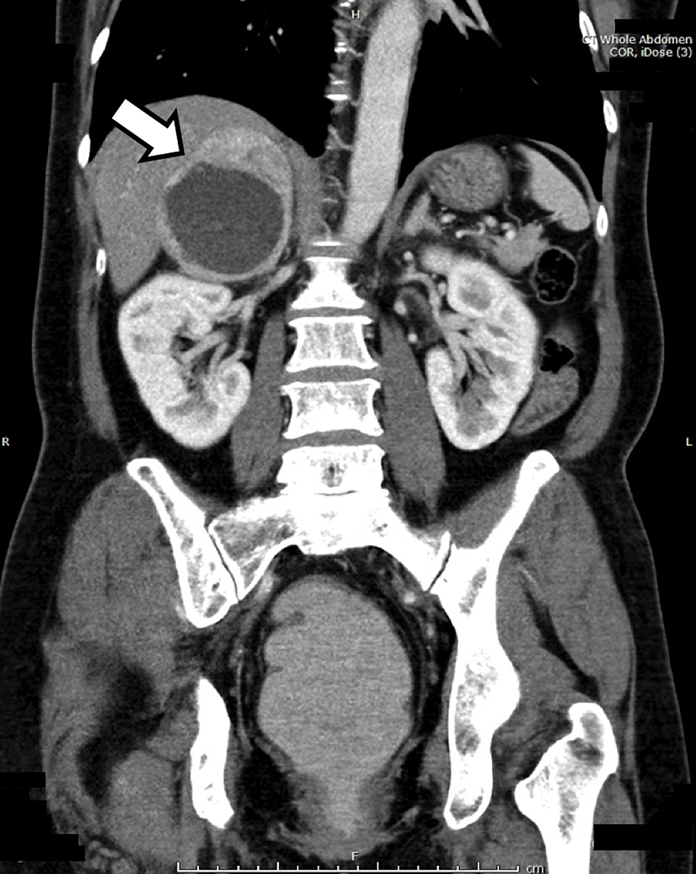 Cureus | Light-intensity Activity-related Nausea: An Unusual ...