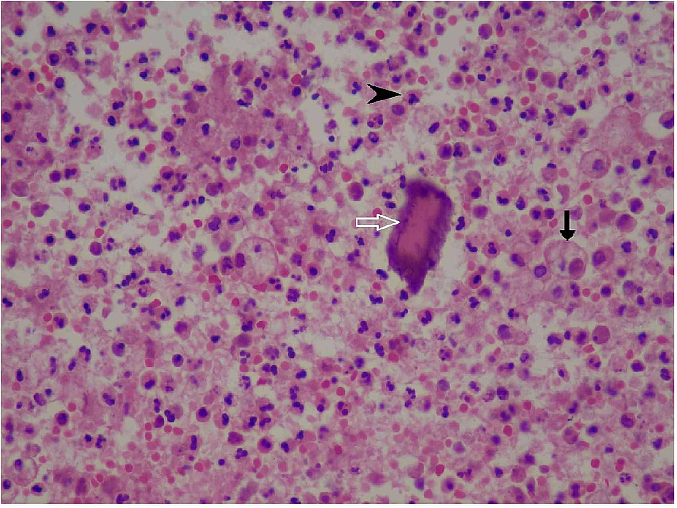 Staphylococcus Aureus Microscope 