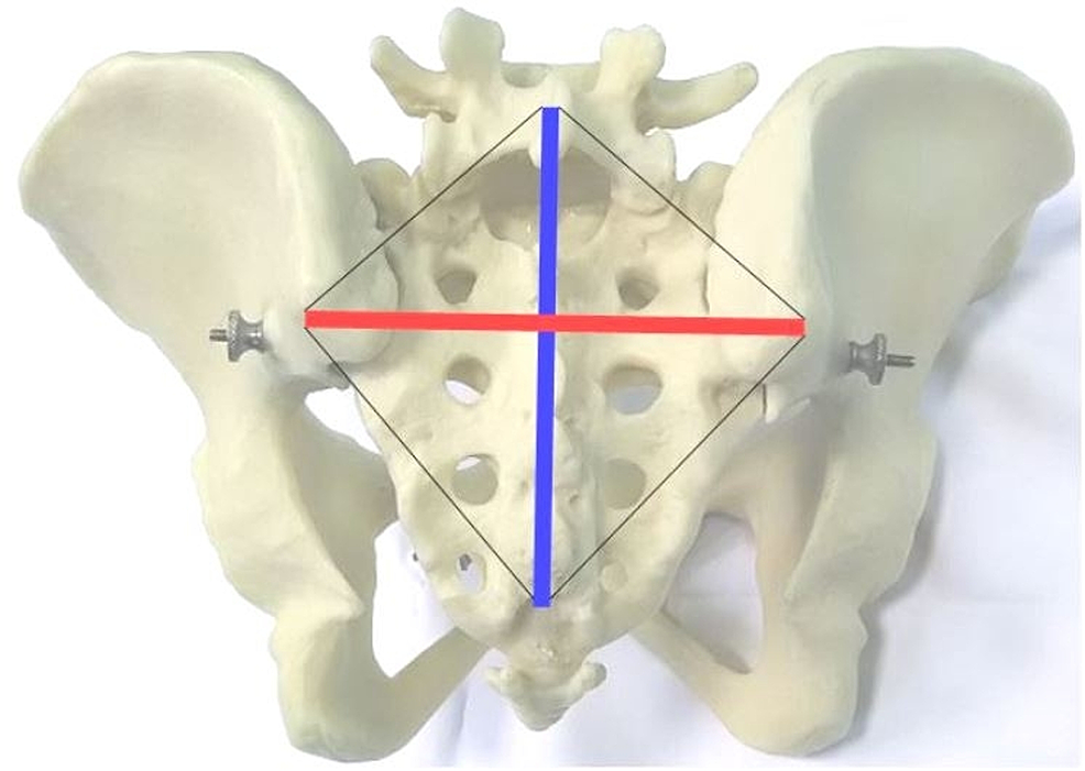 Anatomy of Female Pelvic Area - Stanford Medicine Children's Health