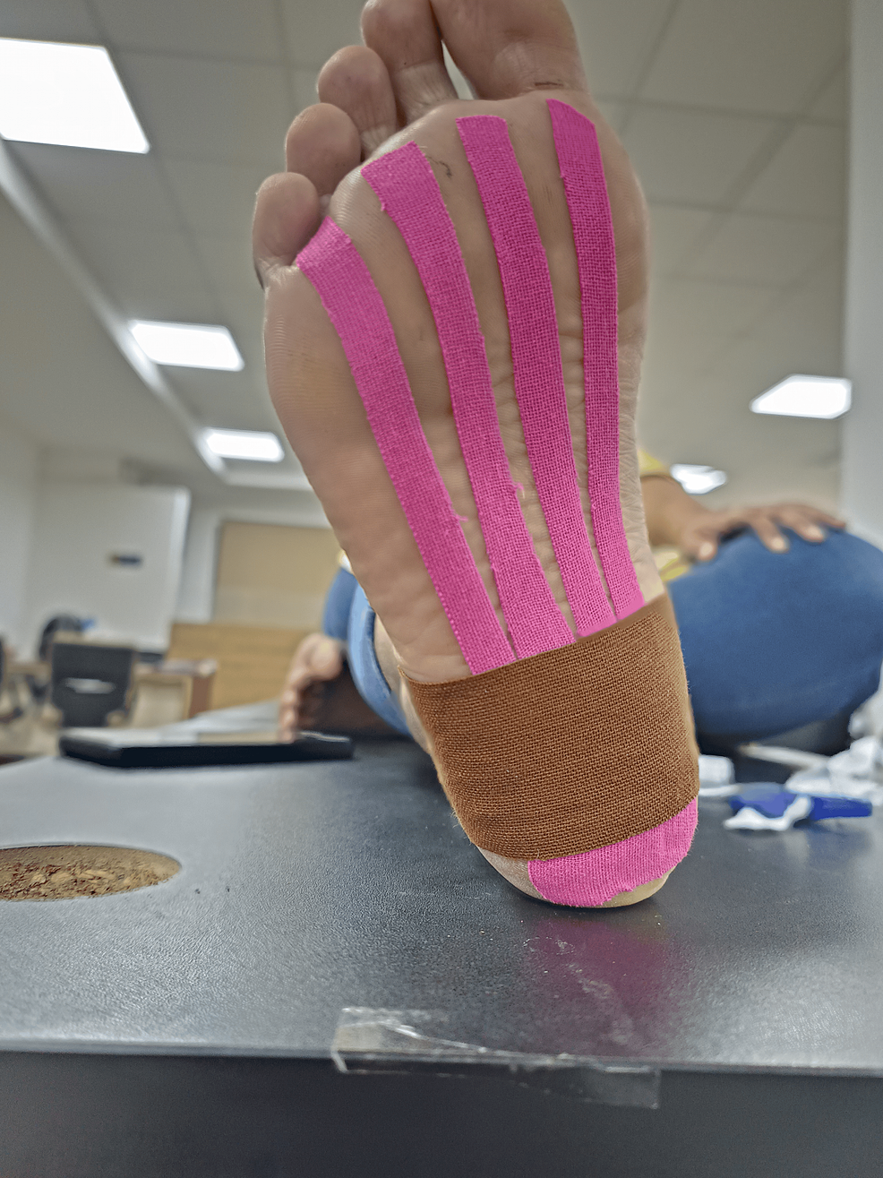 Comprehensive Physiotherapy Rehabilitation Protocol of Plantar