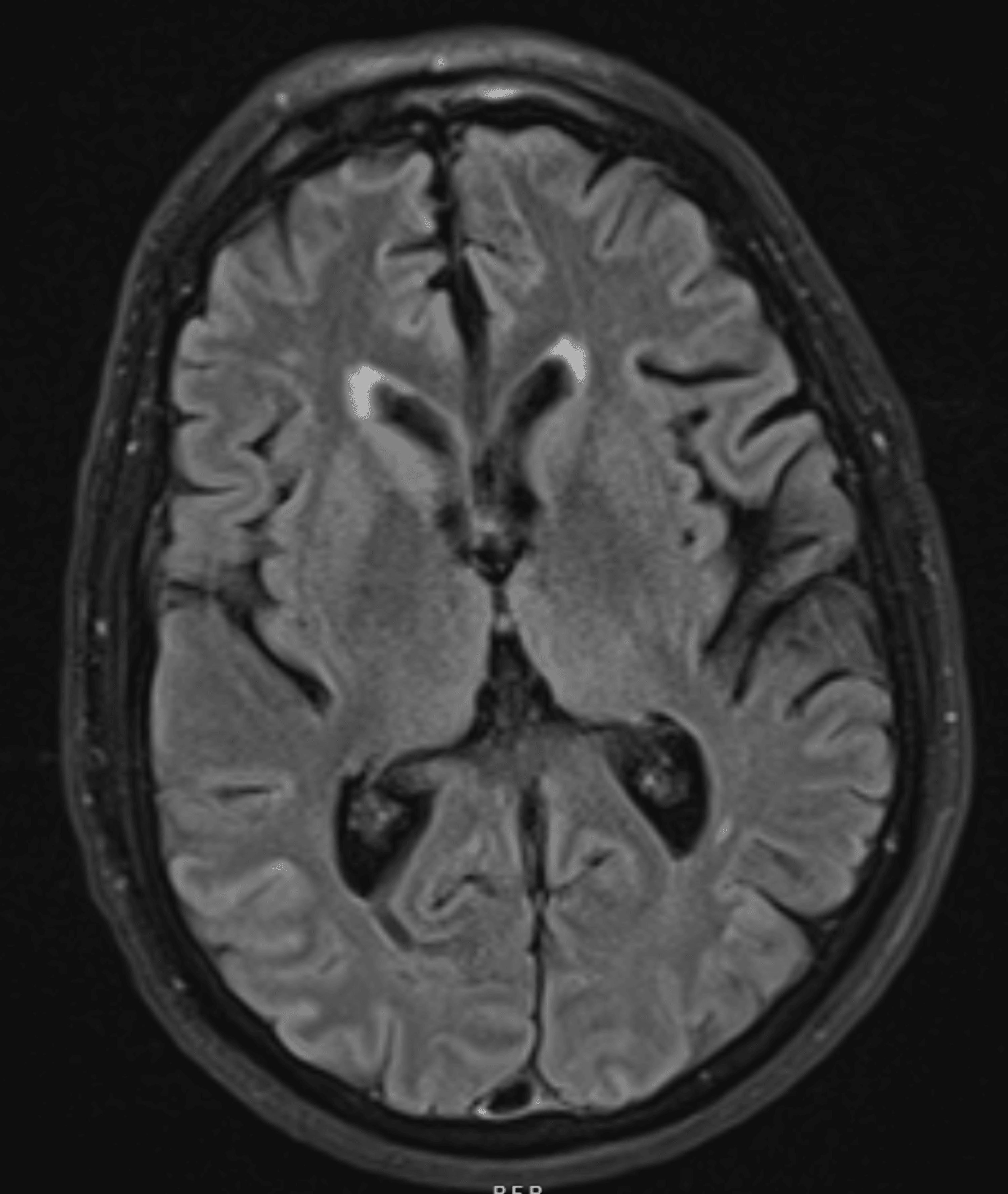 Cureus Addressing the Unmet Needs of Patients With Rapidly