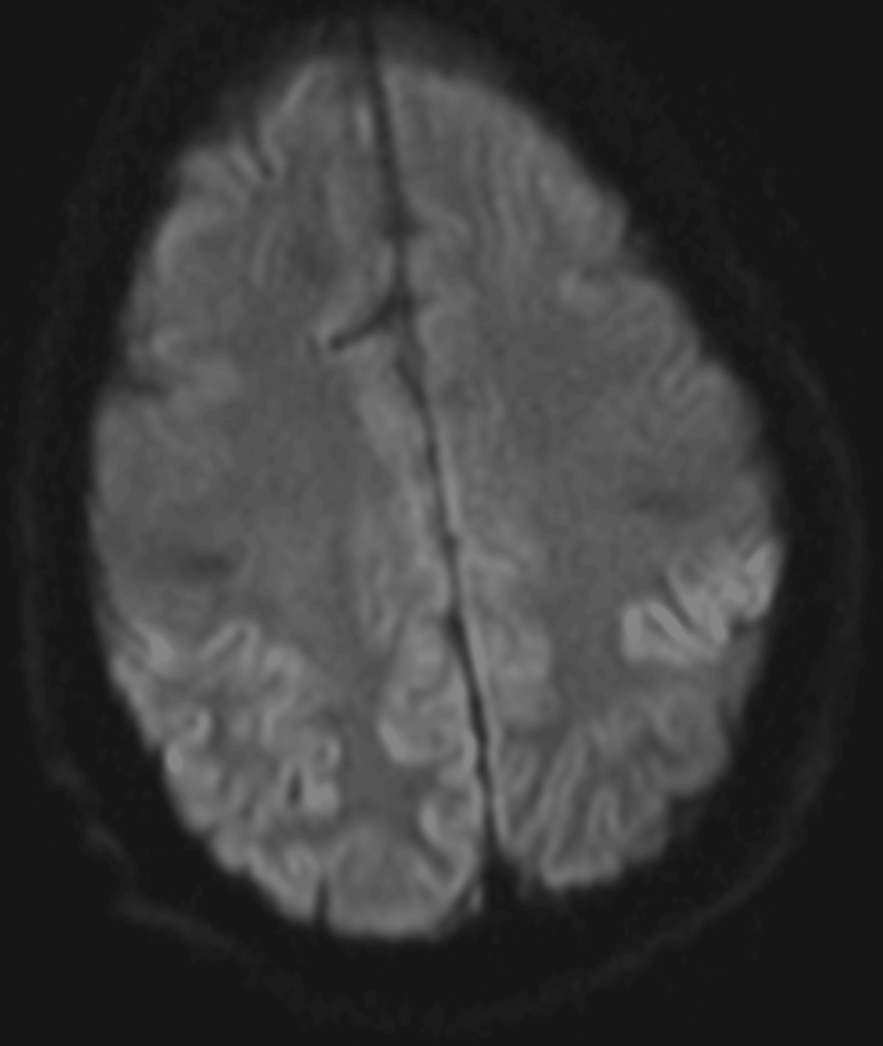 Cureus Addressing the Unmet Needs of Patients With Rapidly