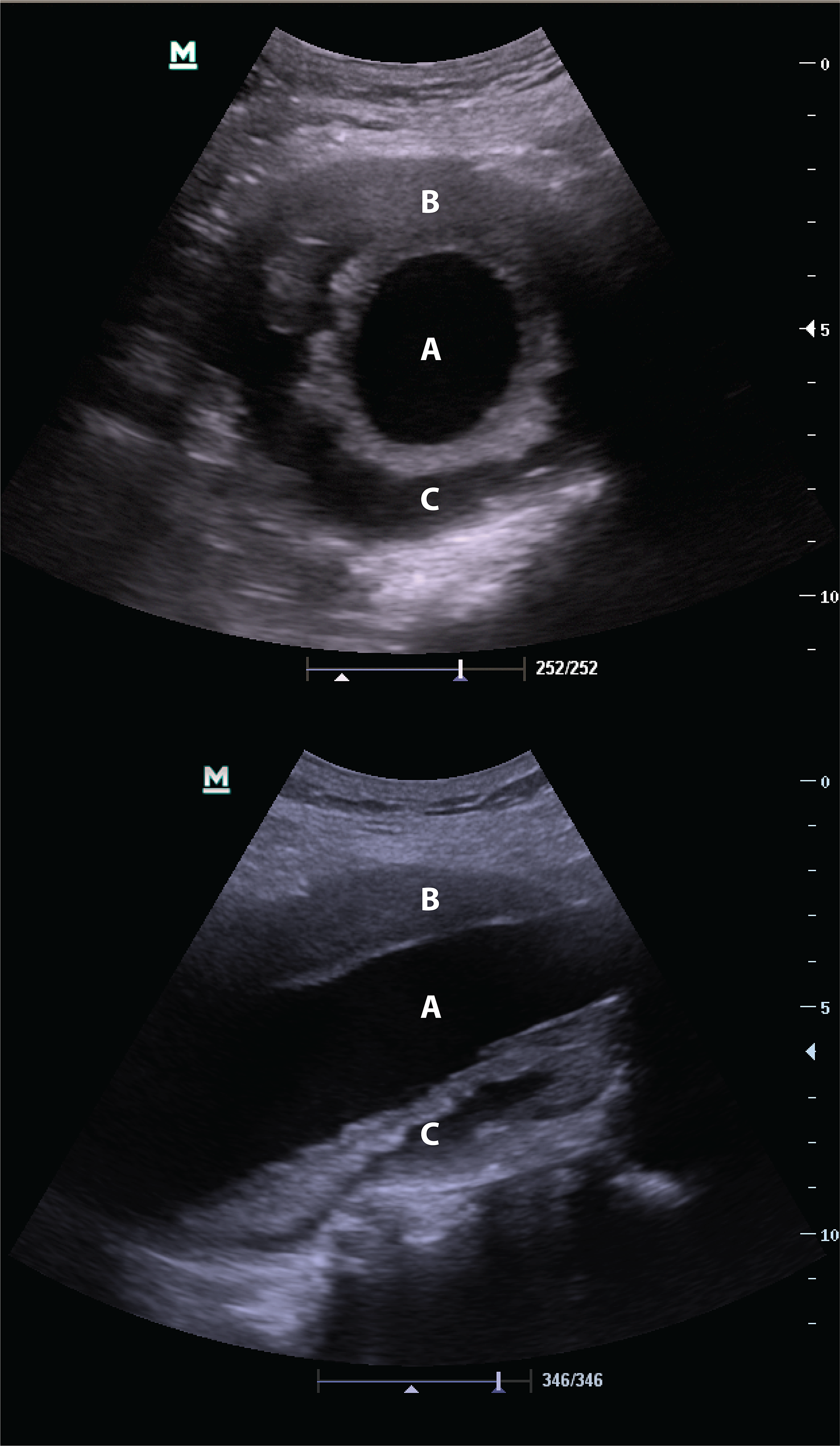 Cureus | Point-of-care Ultrasound Trumps Computed Tomography in a Case ...