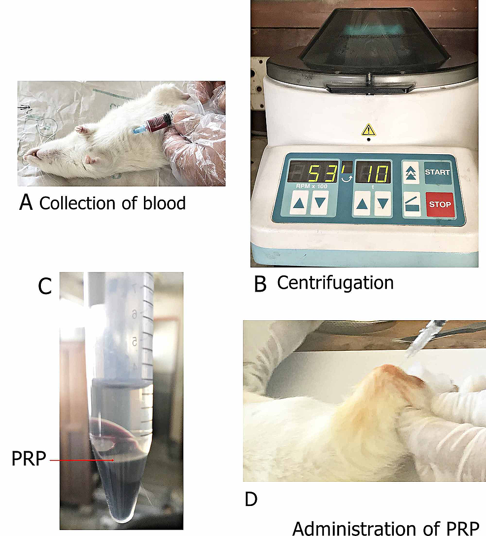 Figure-showing-various-steps-during-the-preparation-of-PRP