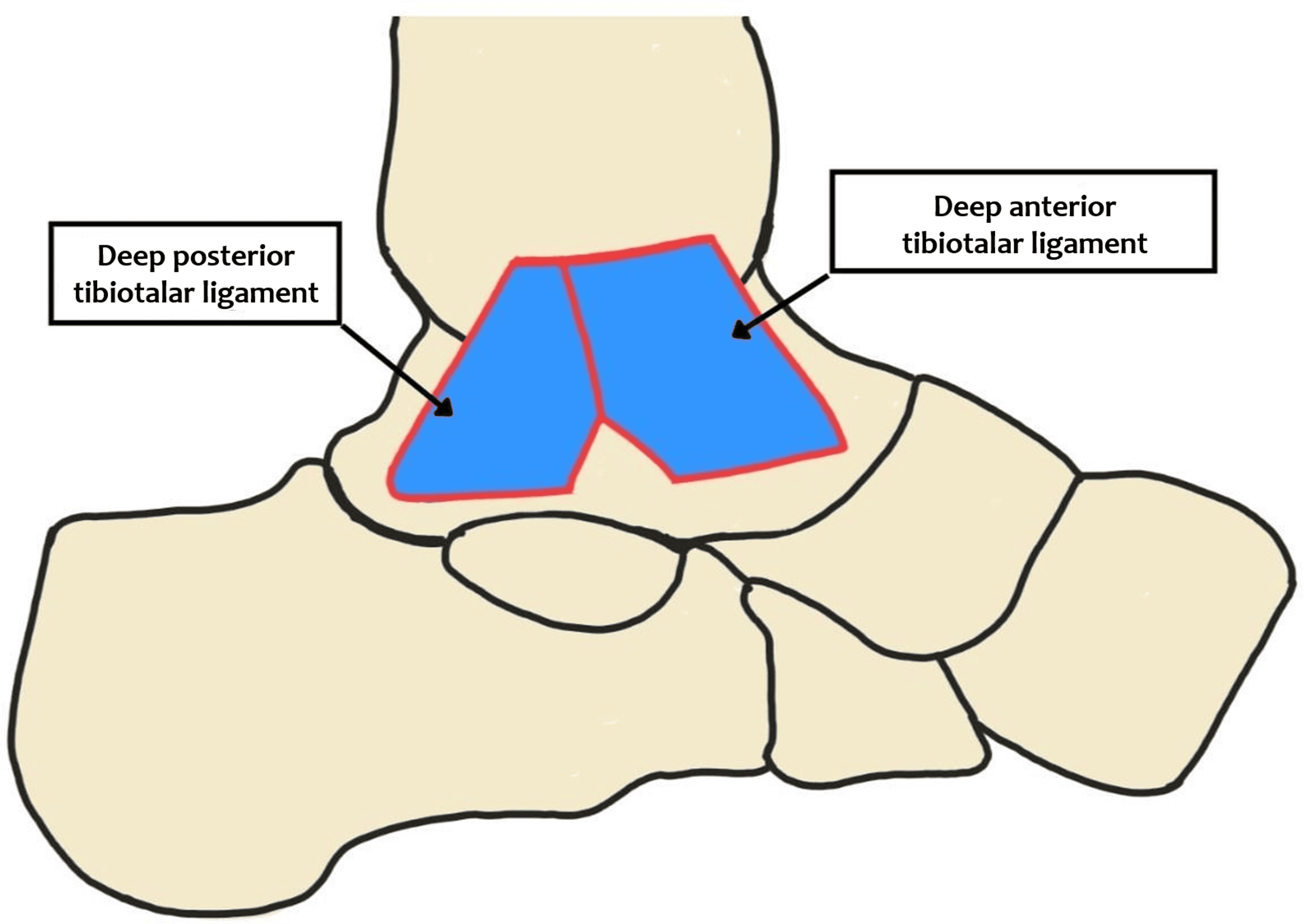 Cureus Combined Deltoid And Spring Ligament Reconstruction Using The Quadrangular Construct 2957