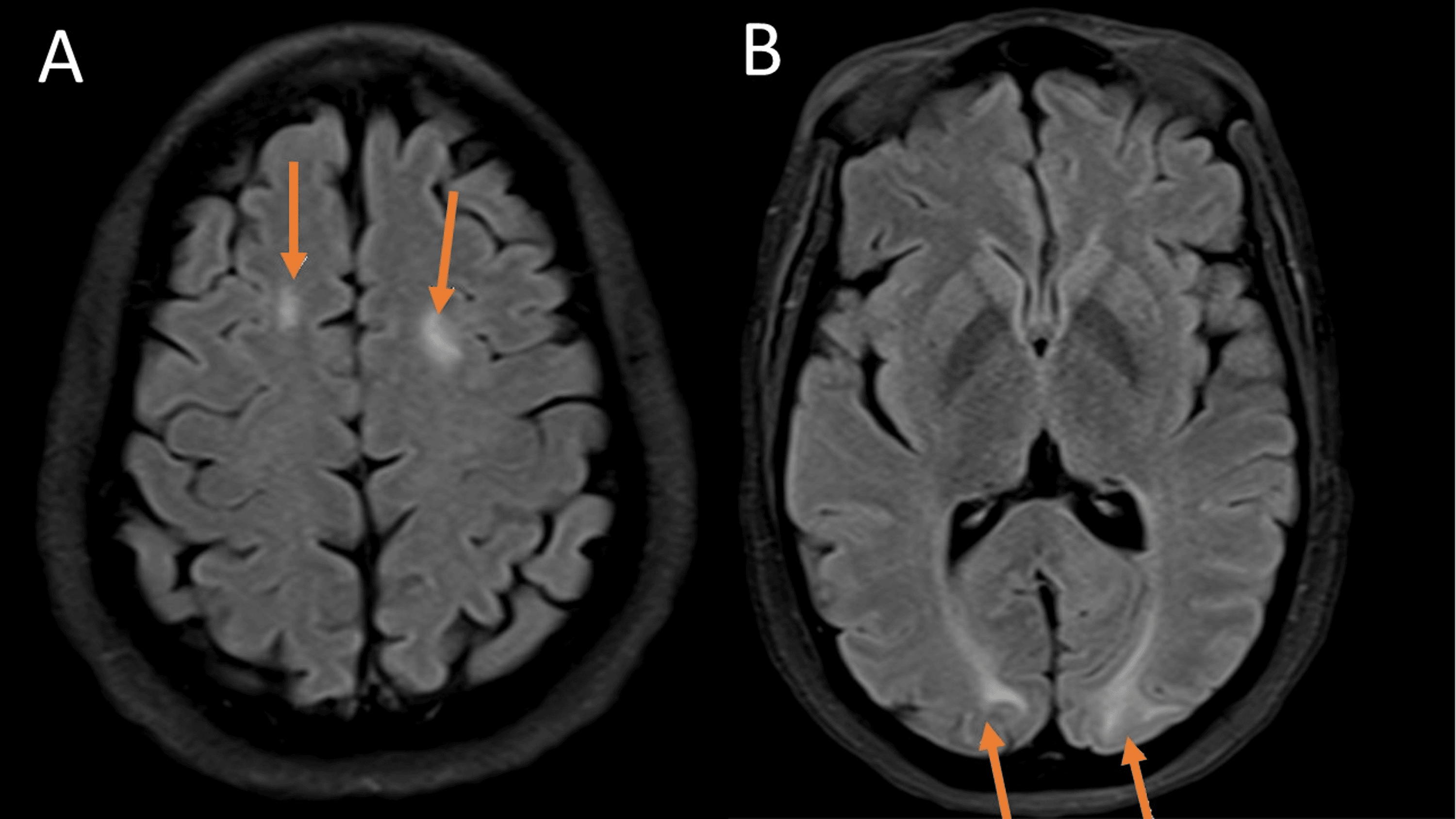 Cureus Using Diagnostic Radiological Imaging Modalities to Explore