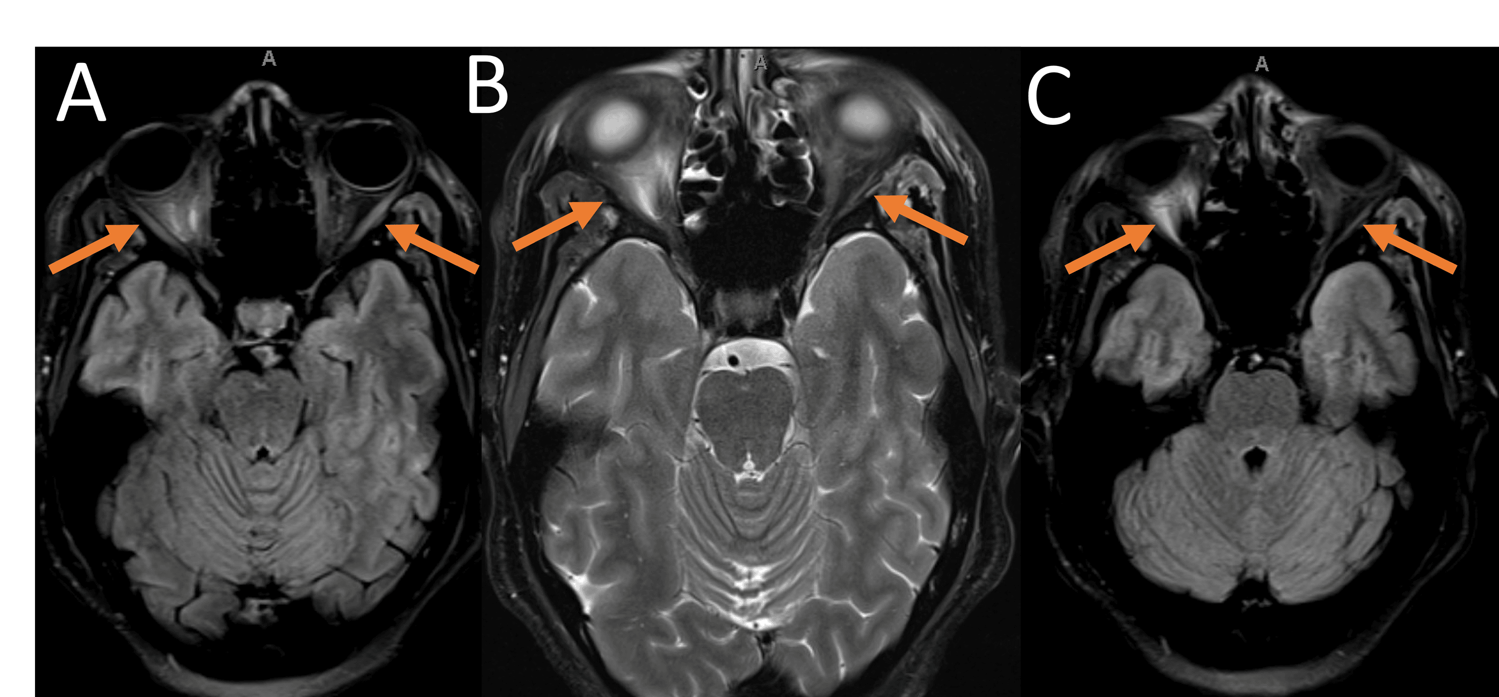 Cureus Using Diagnostic Radiological Imaging Modalities to Explore