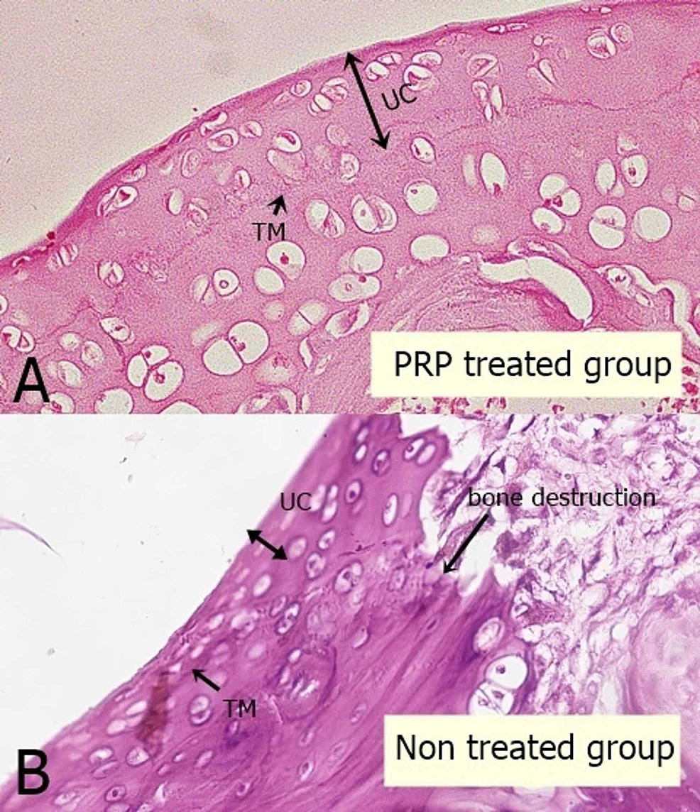 Microscopic-picture-of-the-articular-cartilage-of-rat-tibia-showing-the-uncalcified-cartilage-thickness-and-changes-in-the-chondrocyte-morphology