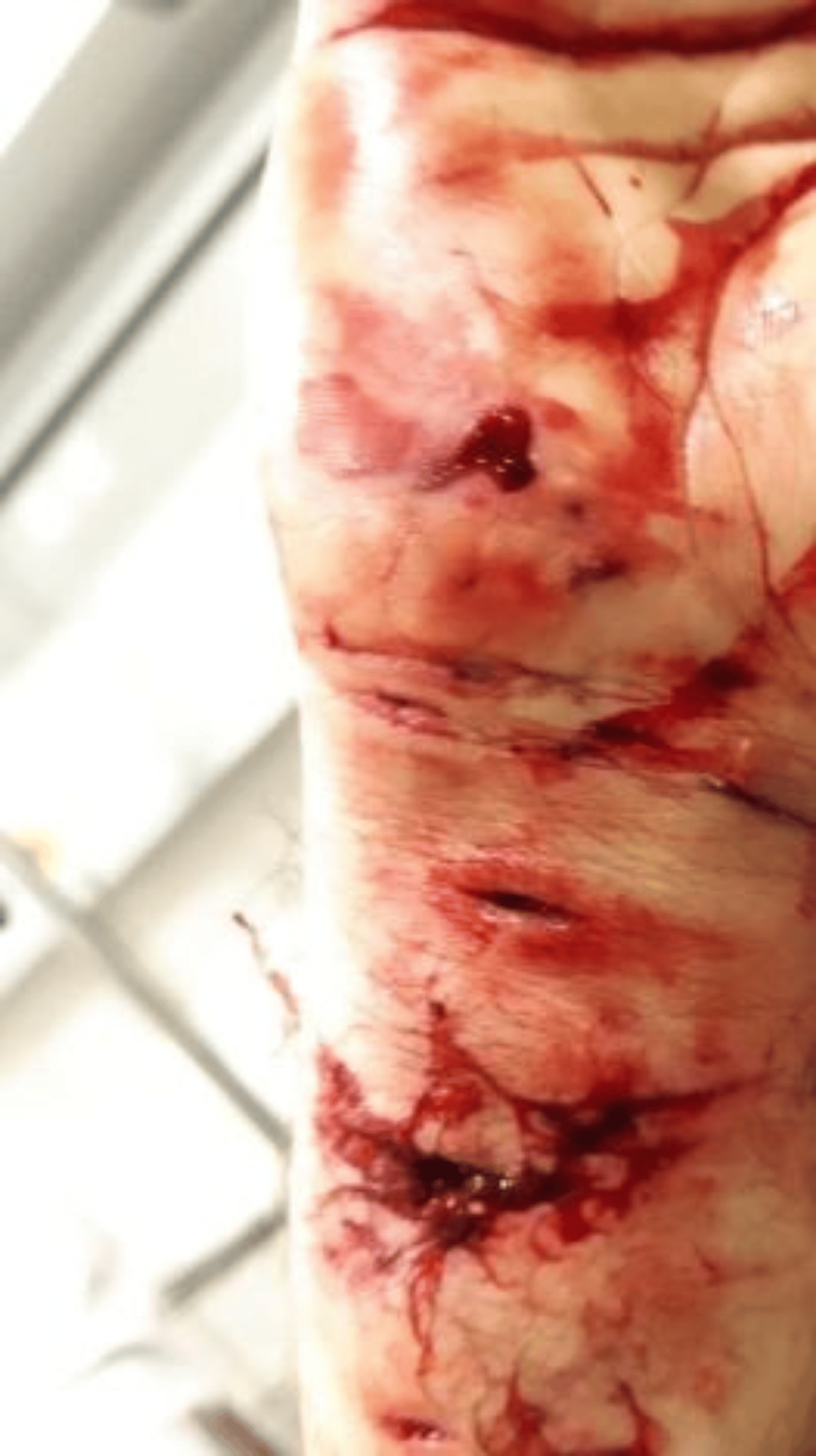 What Does a Dog Bite Infection Look Like: Warning Signs Explained