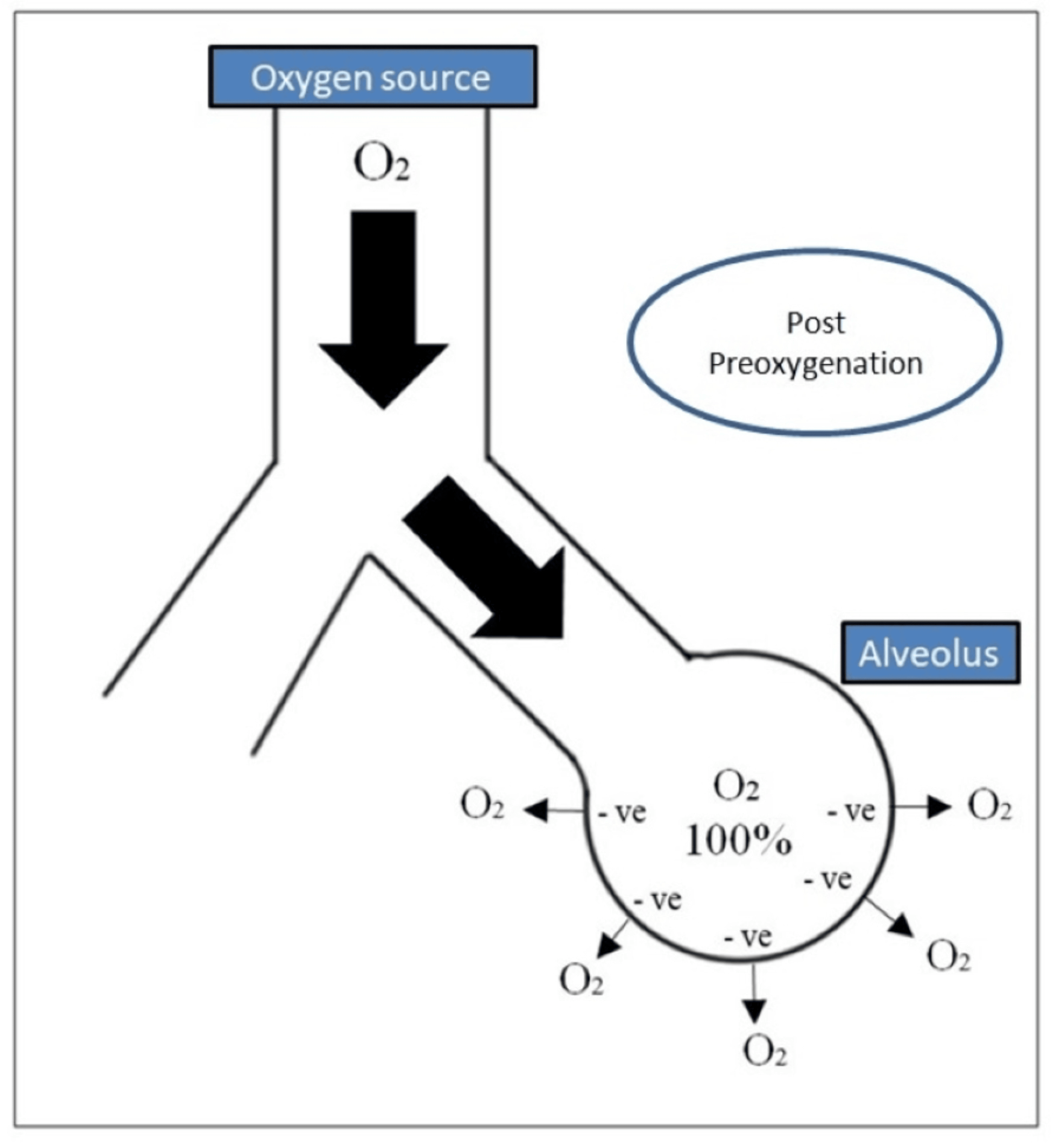 Cureus Apneic Oxygenation A Summarized Review and Stepwise Approach