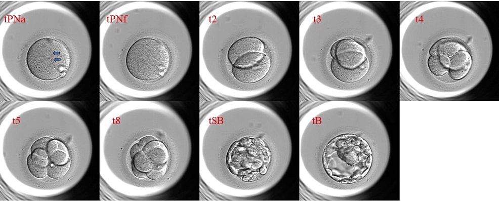 Effect of Male Cigarette Smoking on In Vitro Fertilization (IVF) Outcomes  and Embryo Morphokinetic Parameters