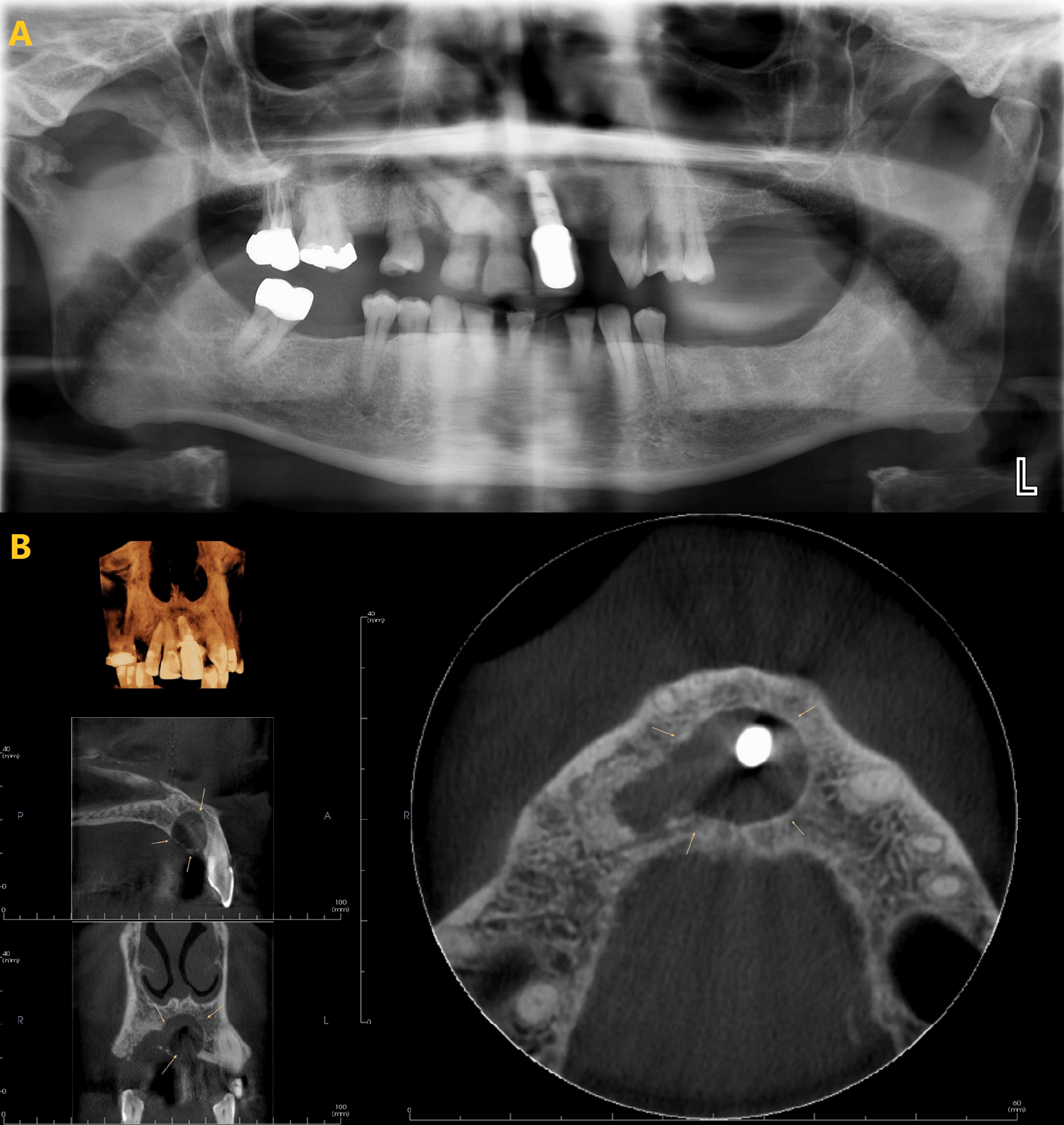 Cureus | The Utility of Cone Beam Computed Tomography Scans in ...