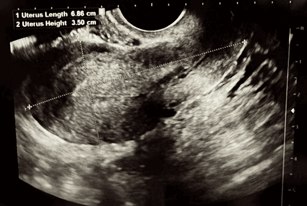 Cureus | A 29-Year-Old Patient With Patau Syndrome: A Case Report on ...