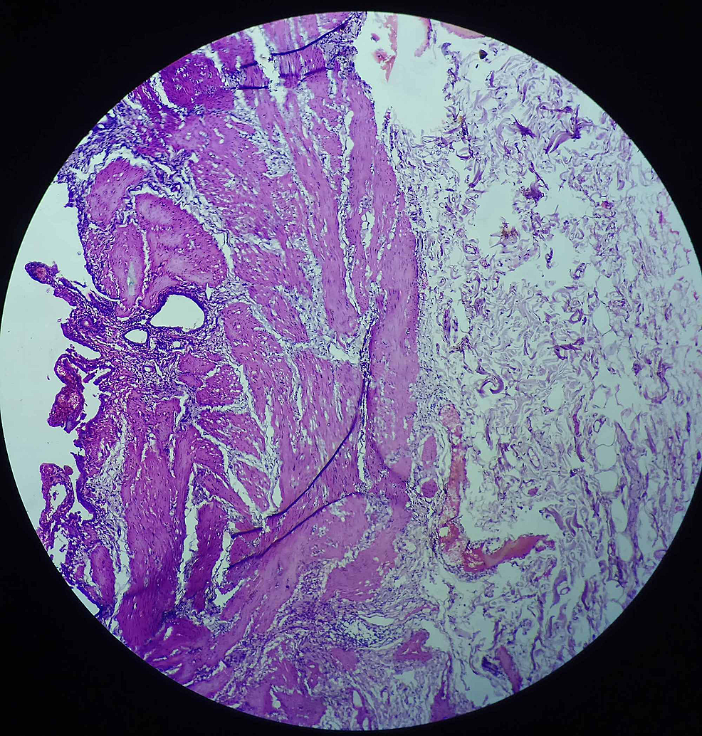 section-from-gall-bladder-specimen-showing-lamina-propria-and