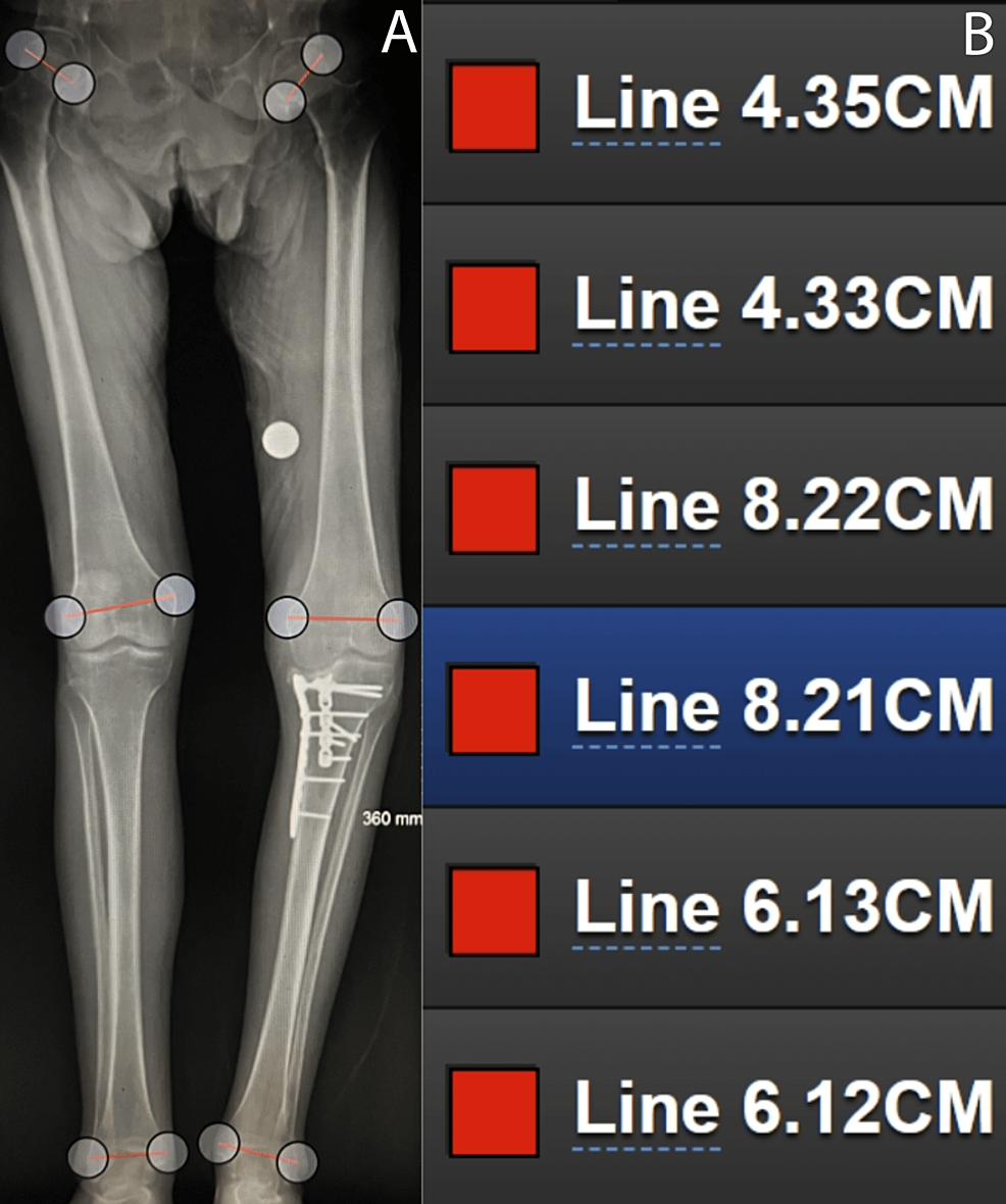 One inch hotsell in mm