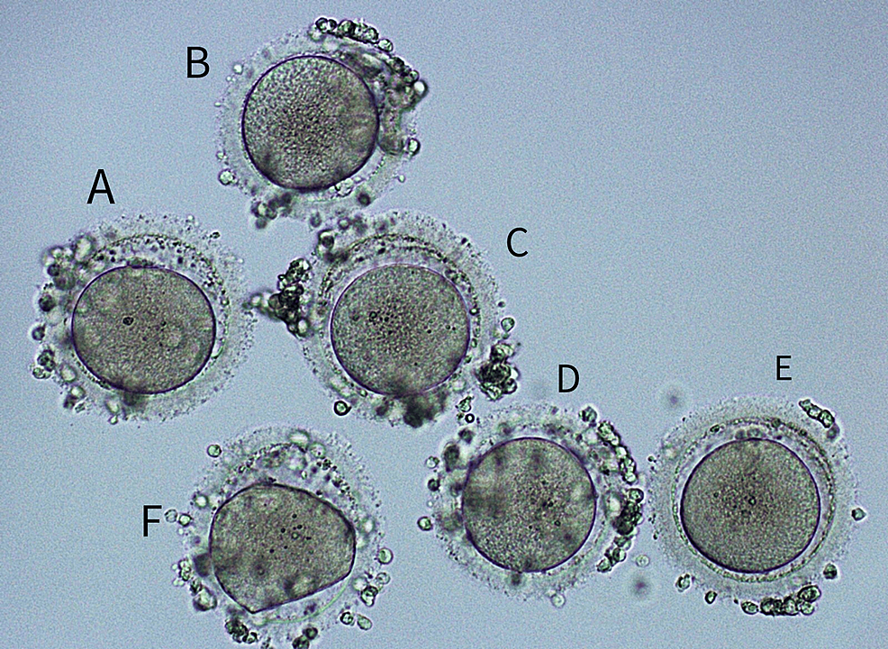 Investigation of the Effect of Dehydroepiandrosterone (DHEA) on In