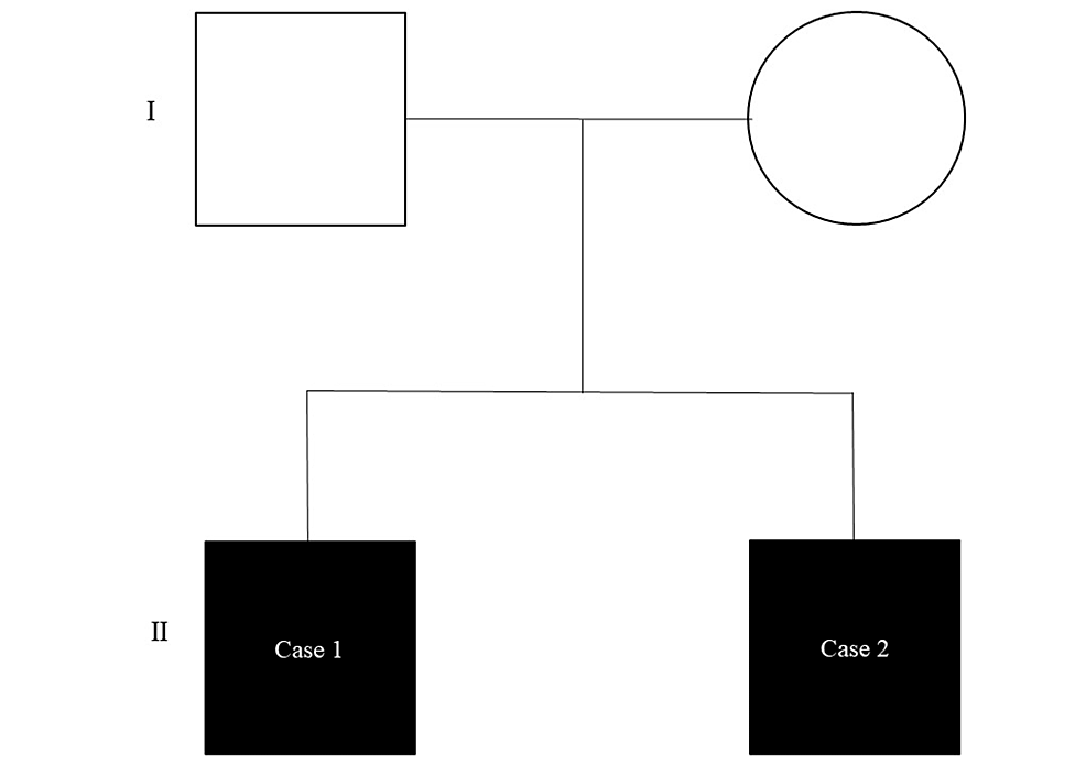 Characteristics of Craniofacial Morphology and Occlusion in Shwachman