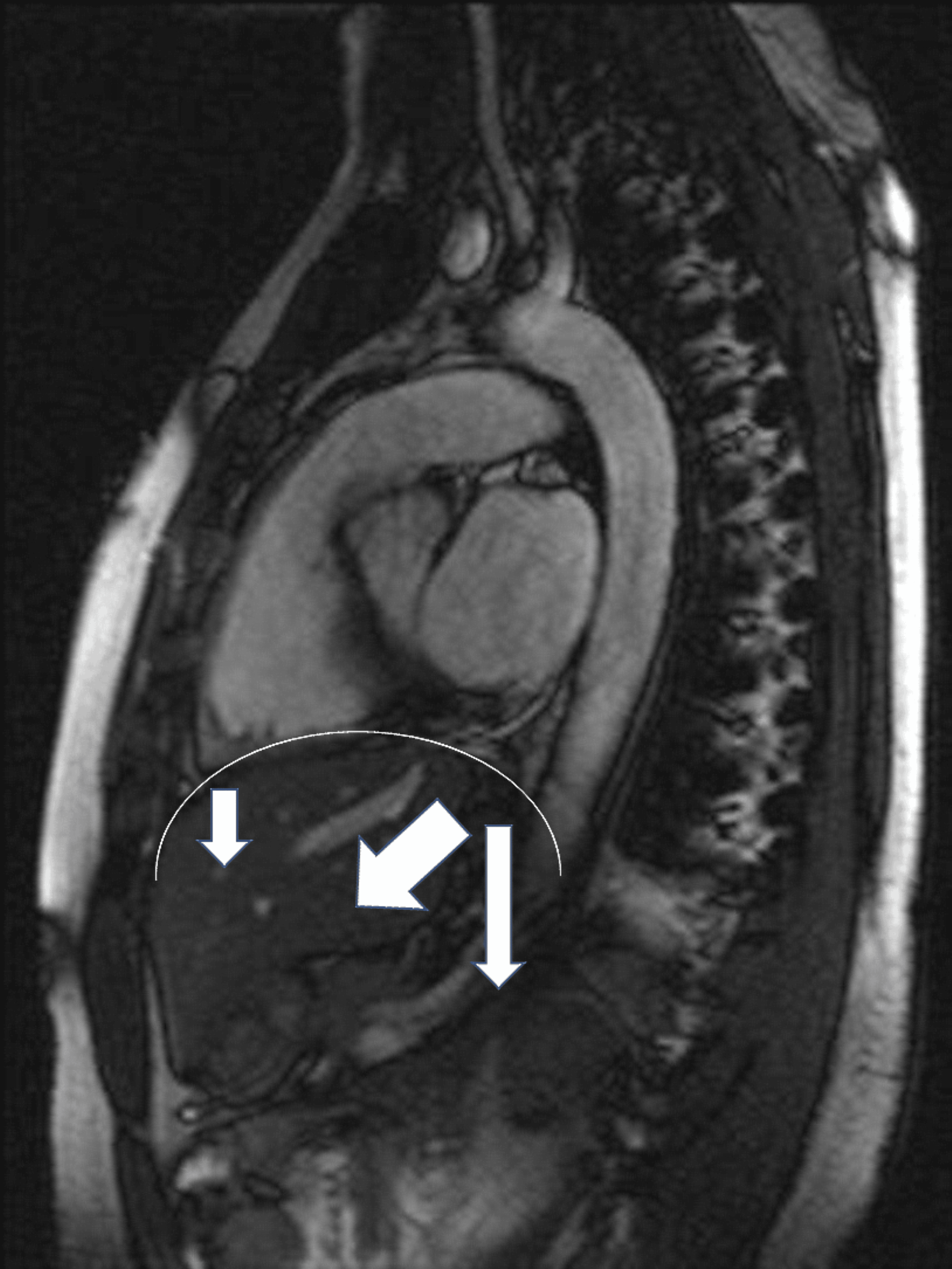 Symptoms Arising From the Diaphragm Muscle Function and Dysfunction