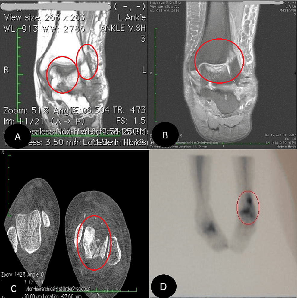 MRI,-CT-scan,-and-technetium-99m-(Tc-99m)-bone-scan