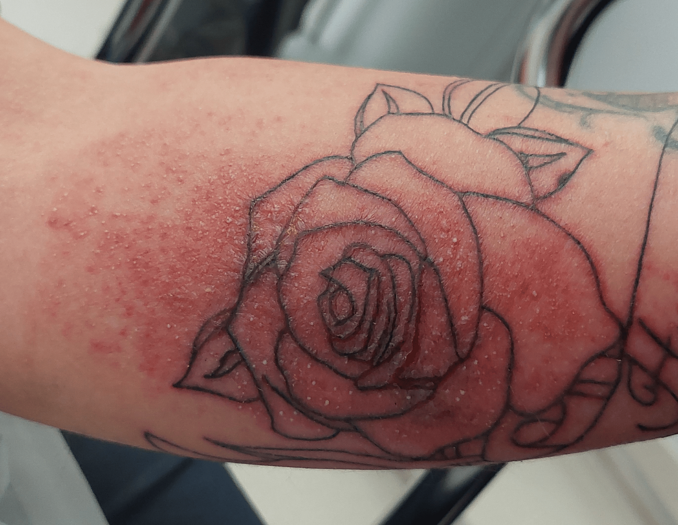 Hi guys. Would it be recommended for someone with eczema to get a tattoo? :  r/tattooadvice