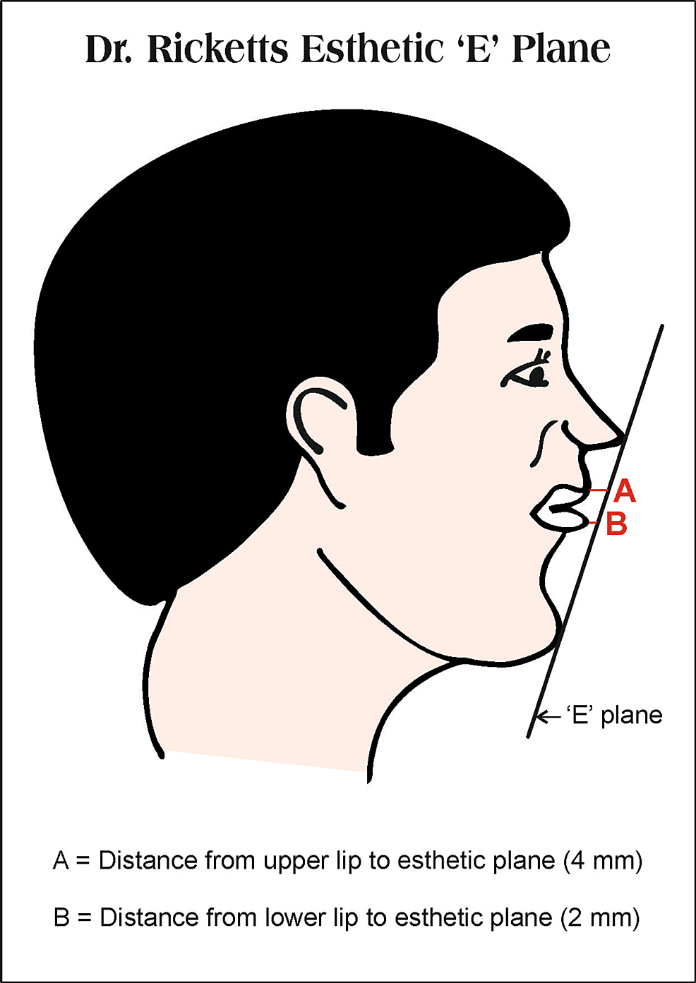 Cureus Comparative Evaluation of Horizontal Lip Position With