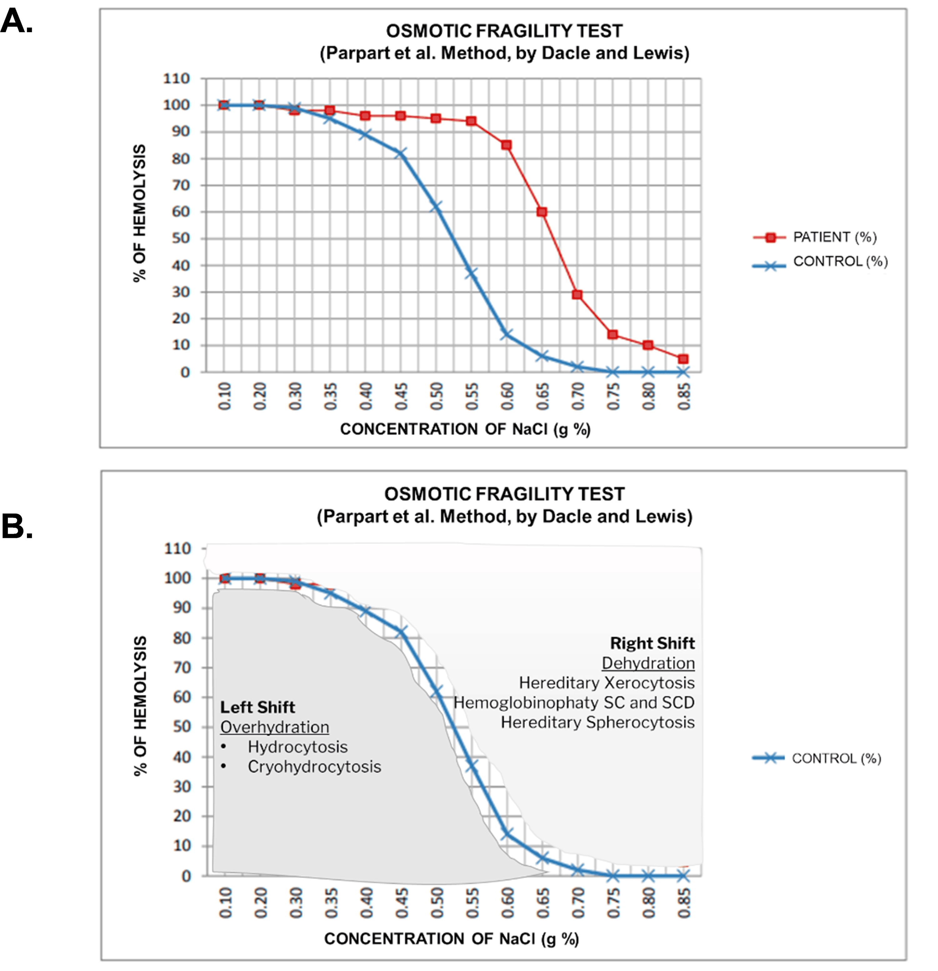 Cureus | A Case Report of Hemolytic Hyponatremia