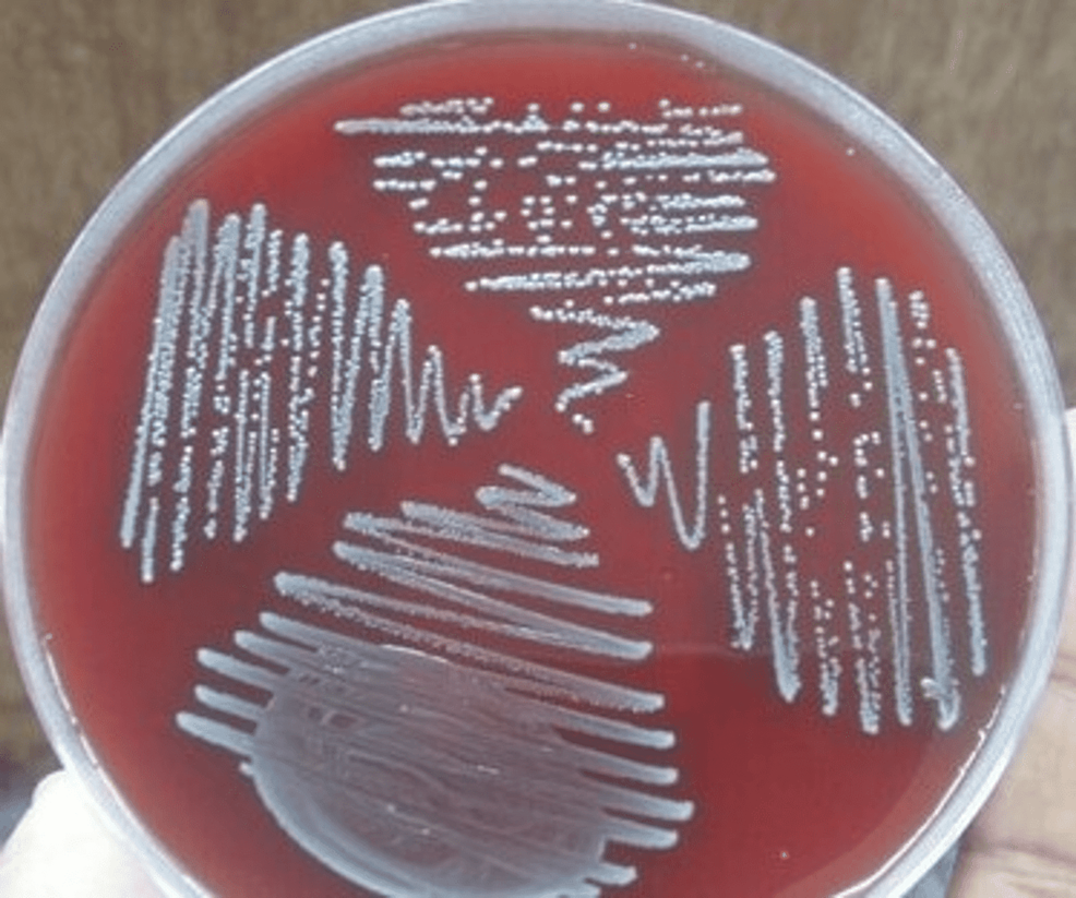 Cureus | Molecular Characterization of Escherichia coli Causing Urinary  Tract Infections Through Next-Generation Sequencing: A Comprehensive  Analysis of Serotypes, Sequence Types, and Antimicrobial and Virulence  Genes | Article