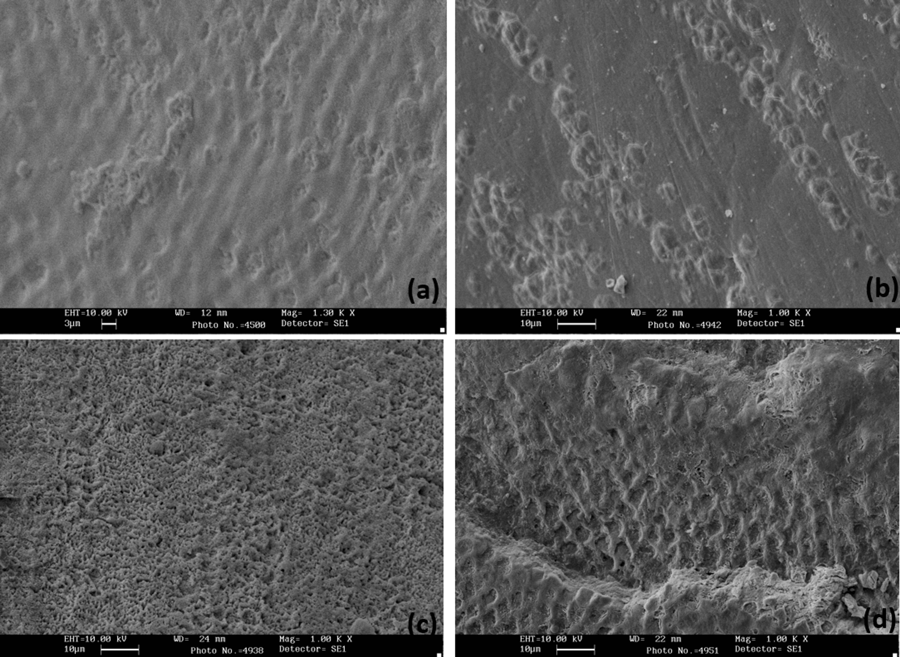 Effectiveness of Different Etching Agents on Enamel Surface and Shear