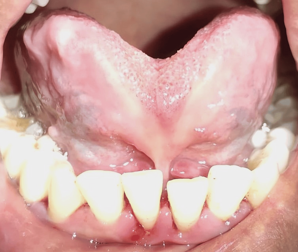 bpc 157 for teeth reddit 🧵 Tips for flossing baby teeth 🧵 As soon as those teeth grow into the  mouth, they need to be flossed in addition to brushing main image 1