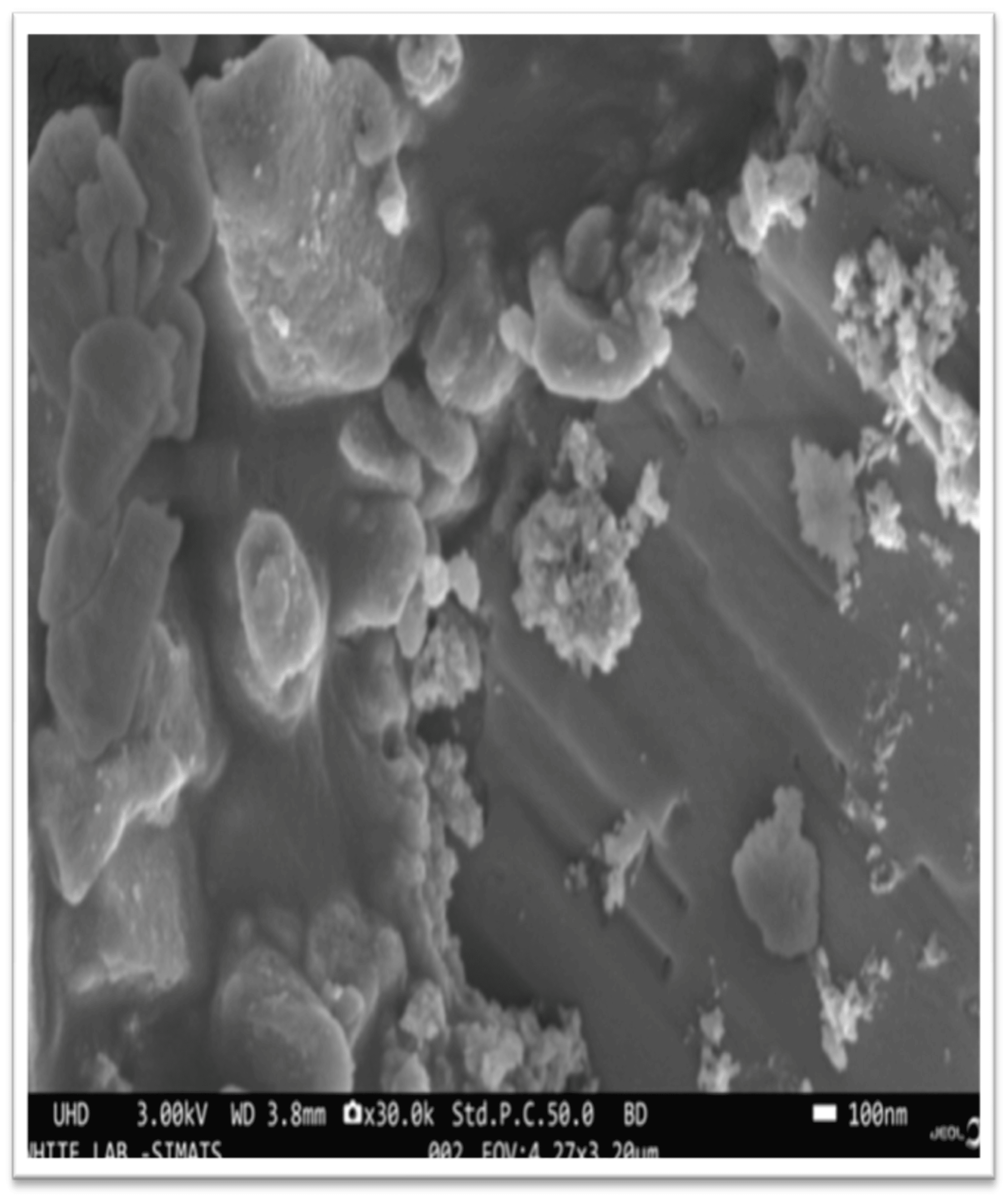 Comparative Analysis of Color Stability and Its Impact on Artificial