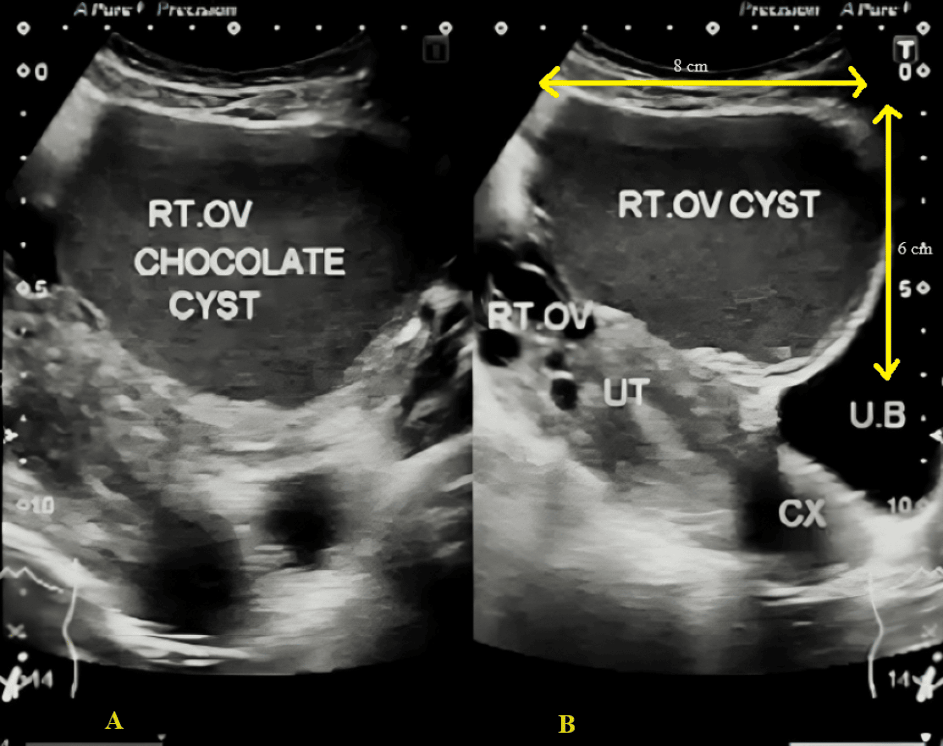 Infertility Challenges A Case Report on the Management of