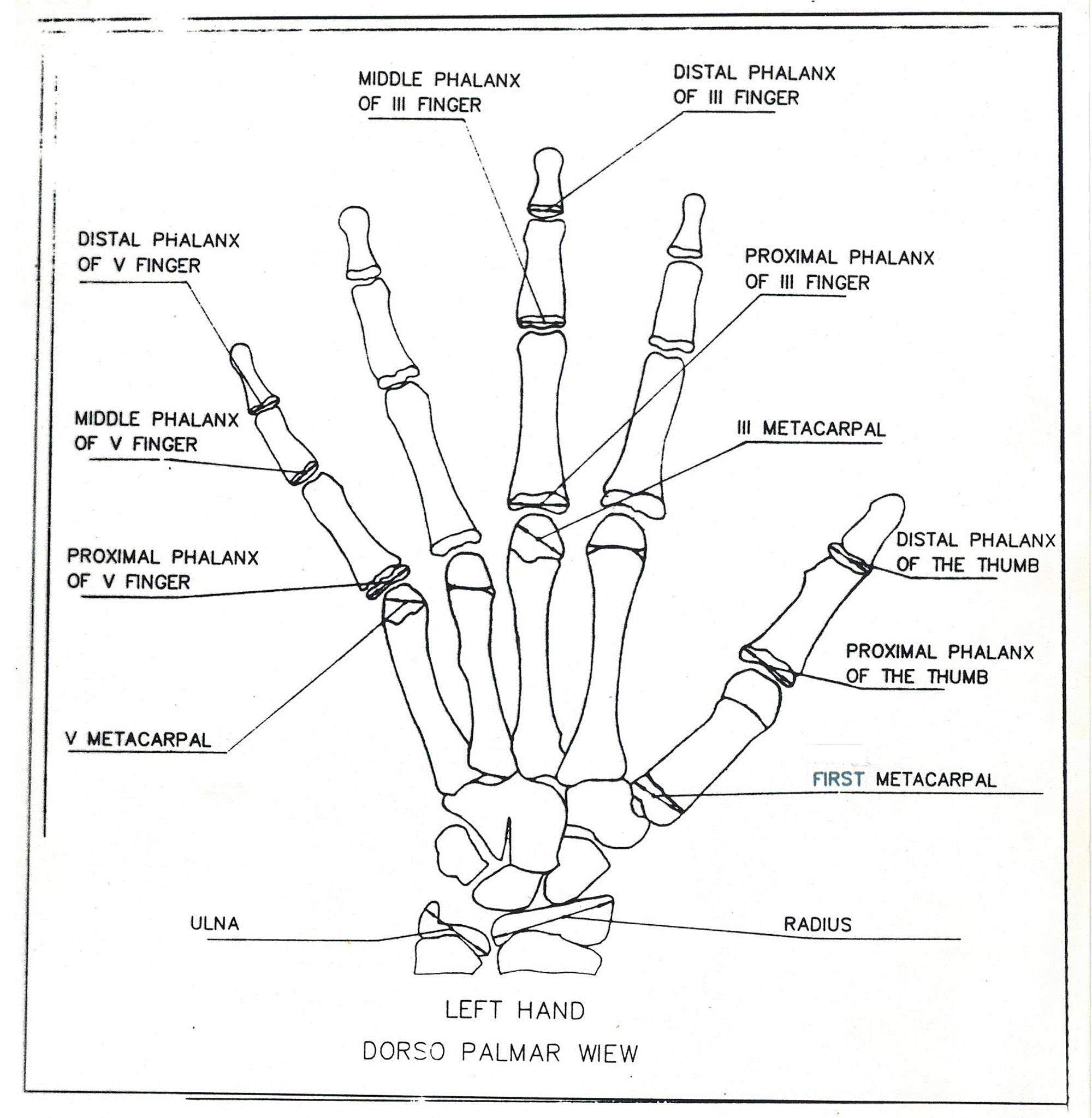 Glossary nightmare responsibility Cureus | Biometric Method for the Ossification Evaluation of Children from  Birth Up to the Ages of Two and Four – Applied to the Metacarpal and  Phalanxes in Spanish Longitudinal Series