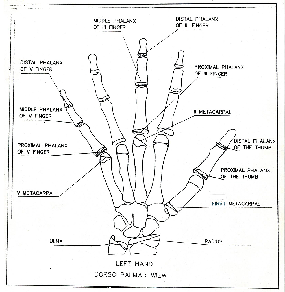 Cureus Biometric Method For The Ossification Evaluation Of Children From Birth Up To The Ages Of Two And Four Applied To The Metacarpal And Phalanxes In Spanish Longitudinal Series