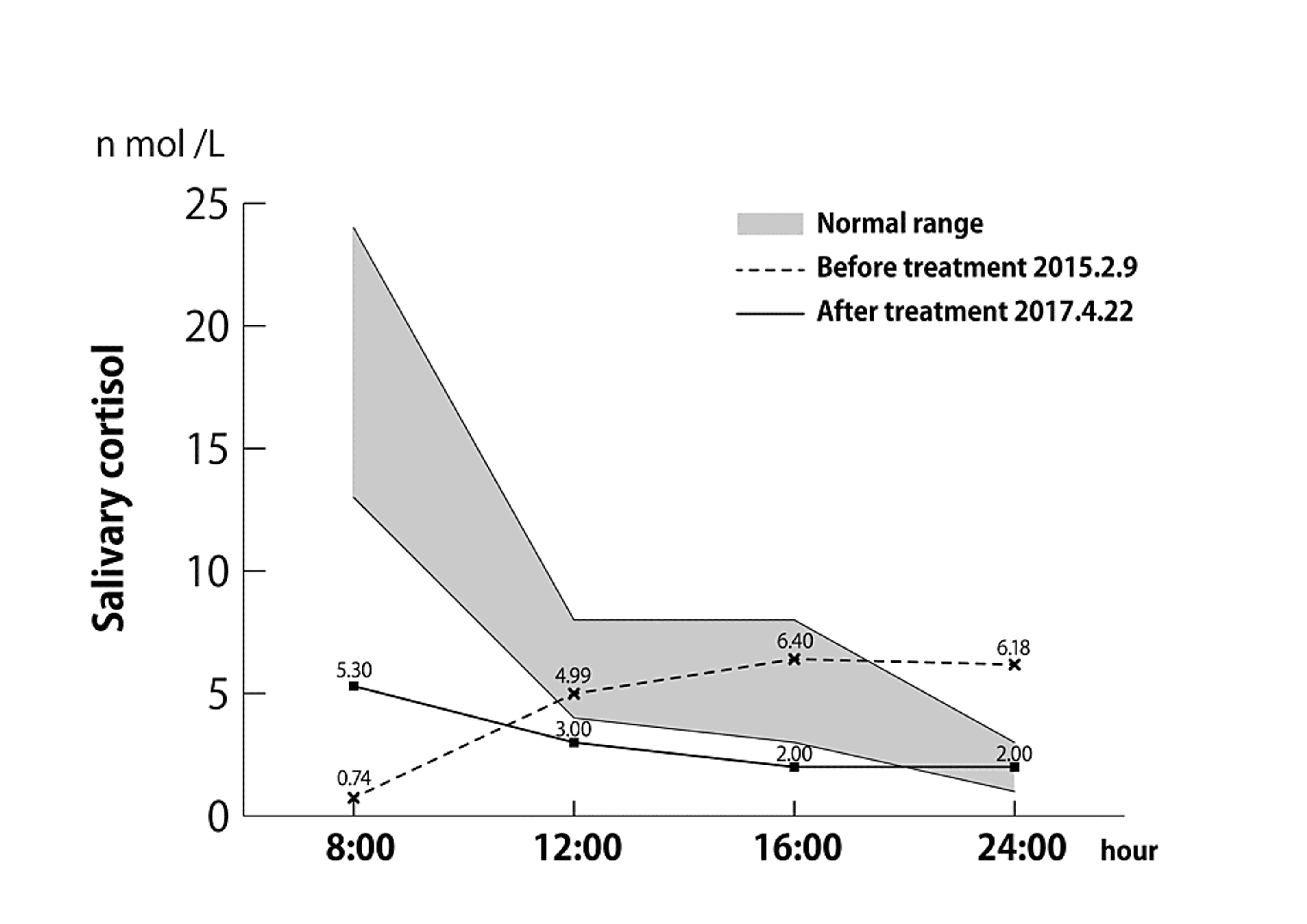 Cureus A Case Report of Chronic Epipharyngitis With Chronic Fatigue