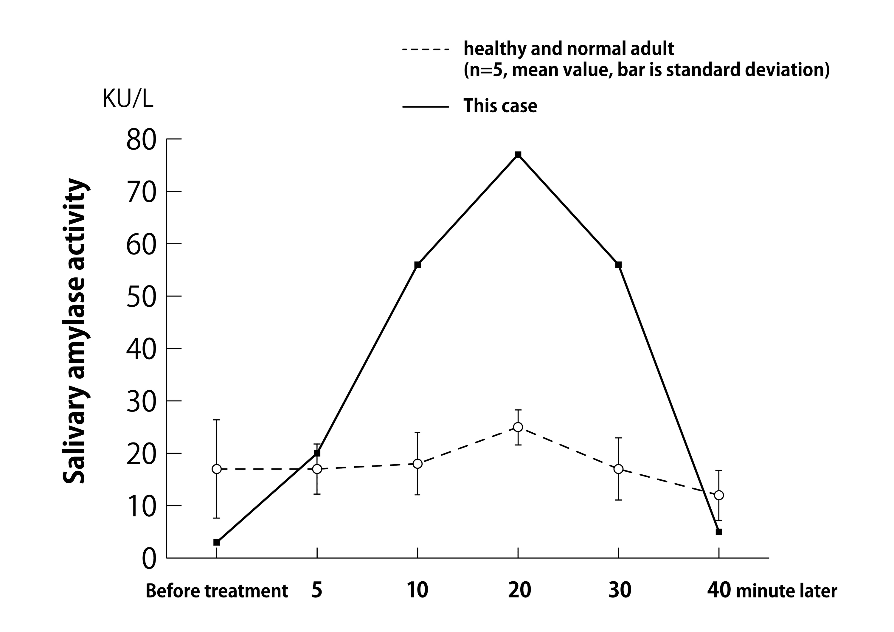 Cureus A Case Report of Chronic Epipharyngitis With Chronic Fatigue
